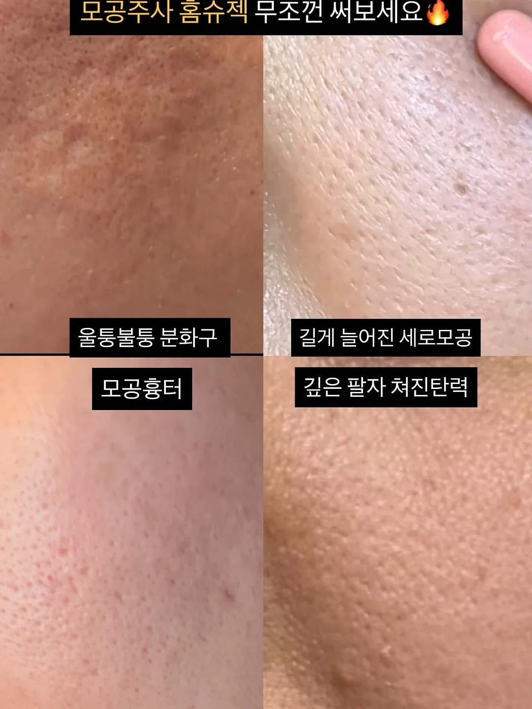 오닐 하와이안 셔츠 3