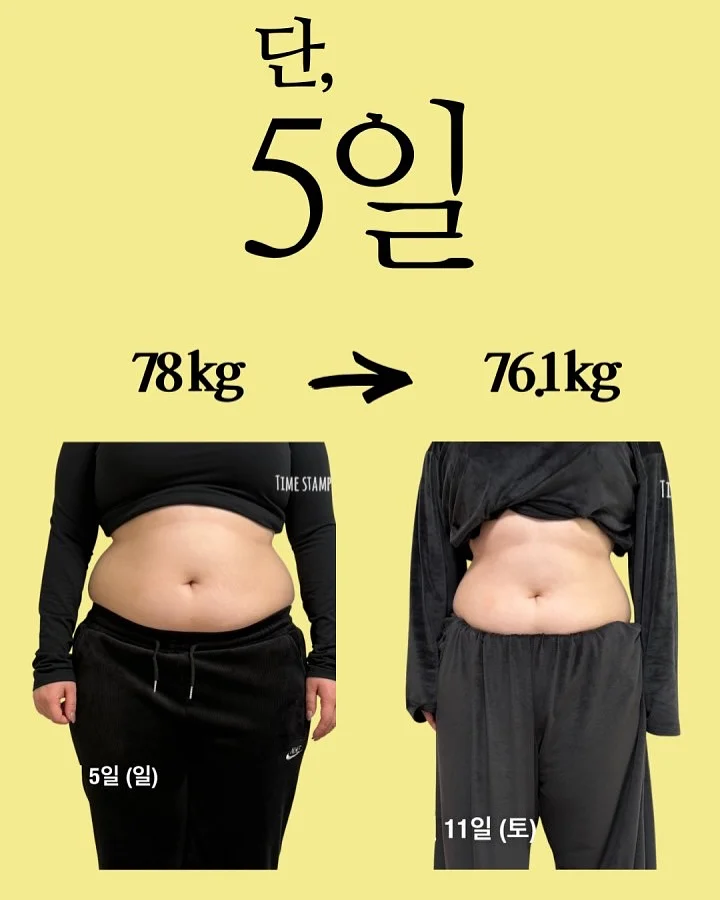 착장 11