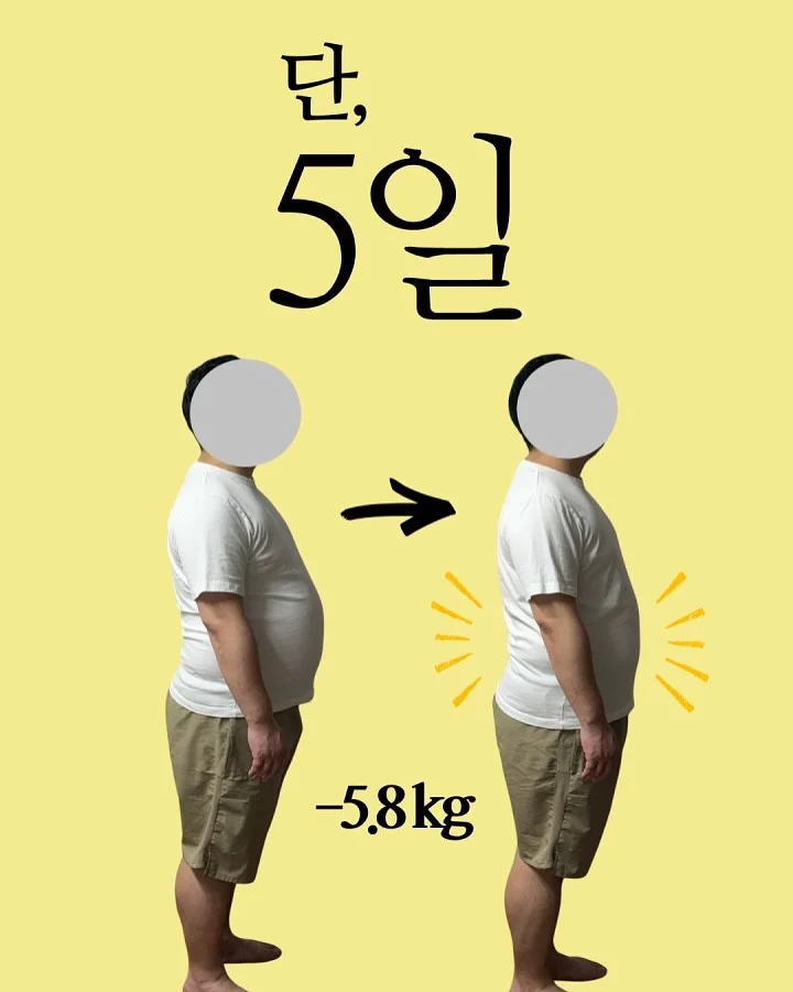 착장 10