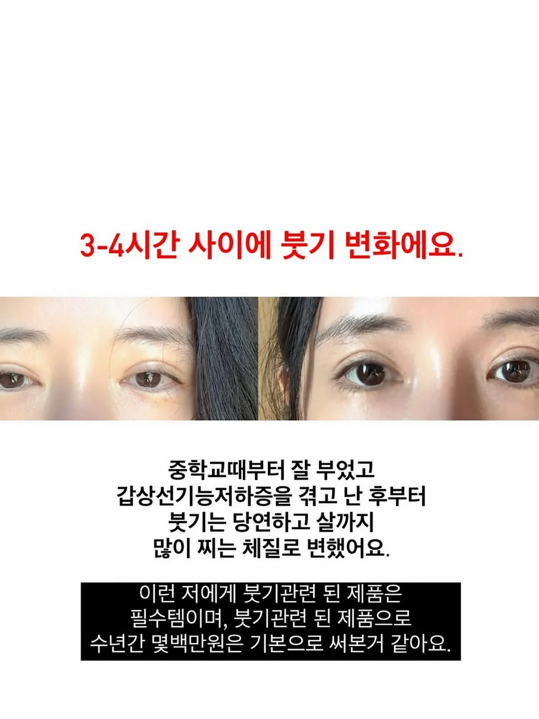 메디큐브 버블세럼 2