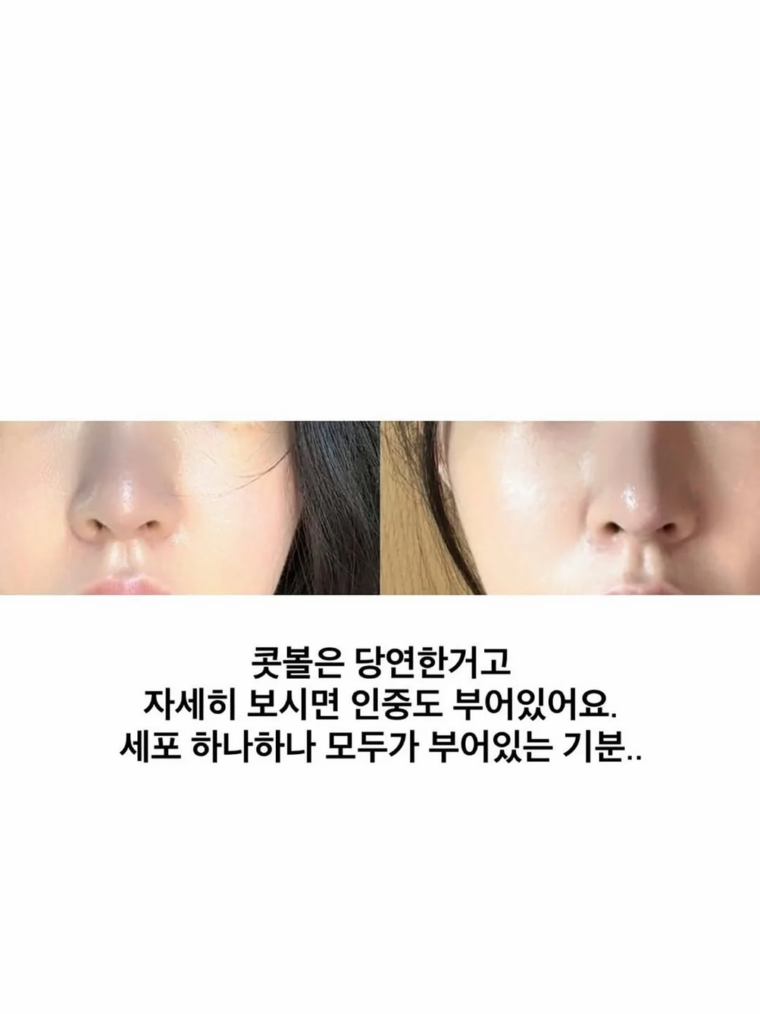 메디큐브 버블세럼 3