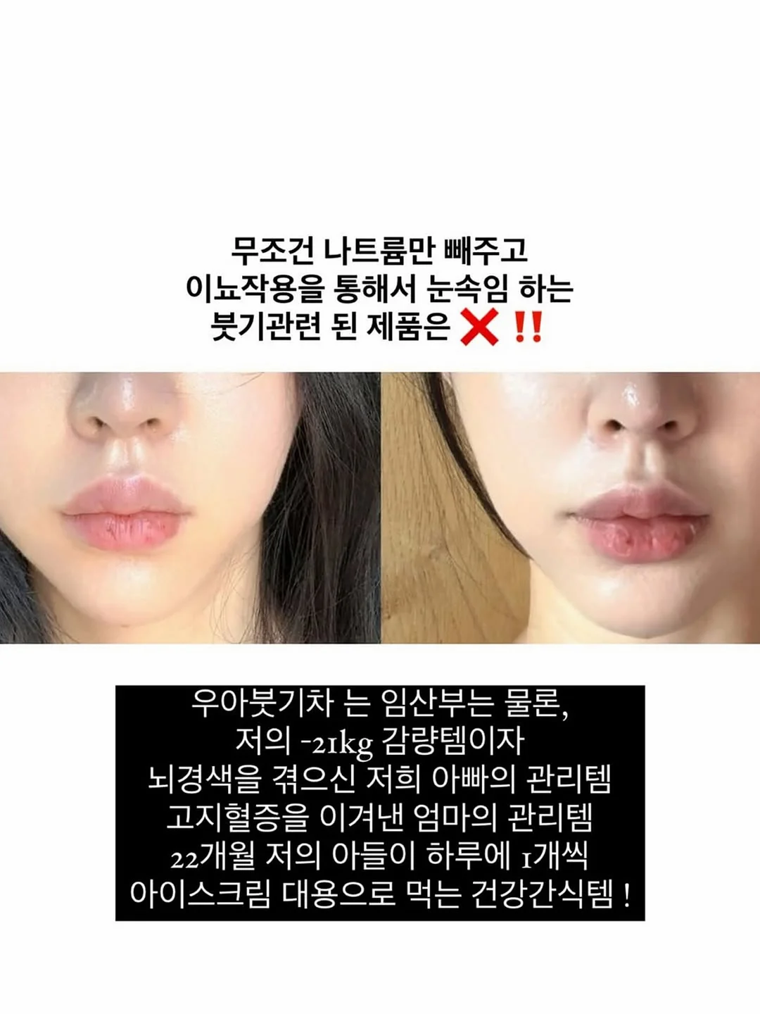 메디큐브 버블세럼 4
