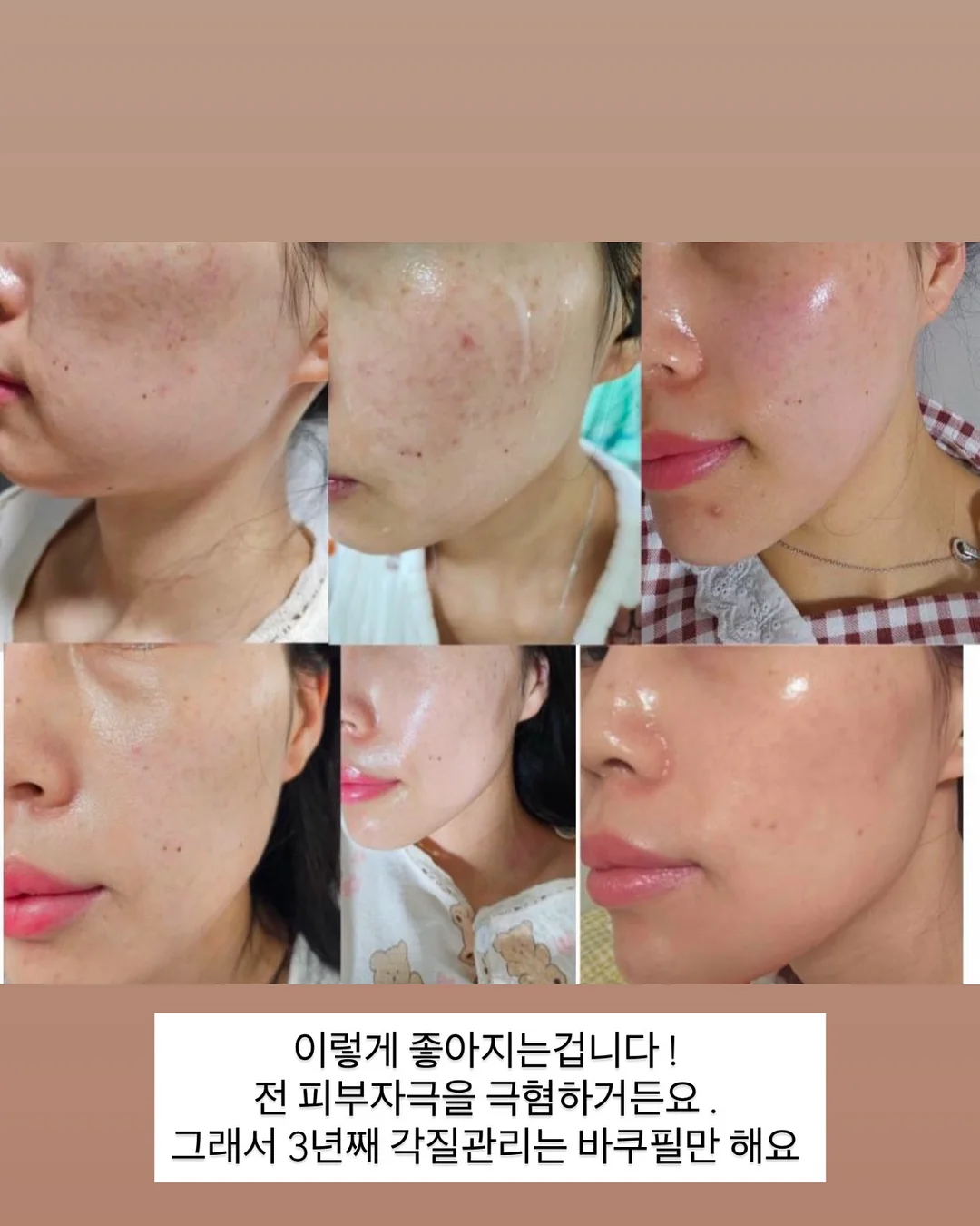 후드집업 13