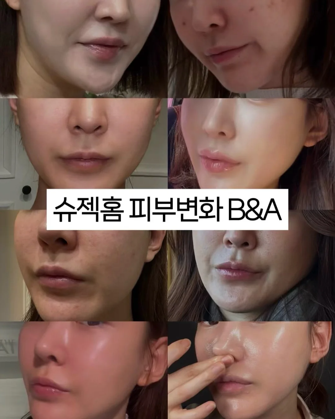 베실 남성 바람막이 2