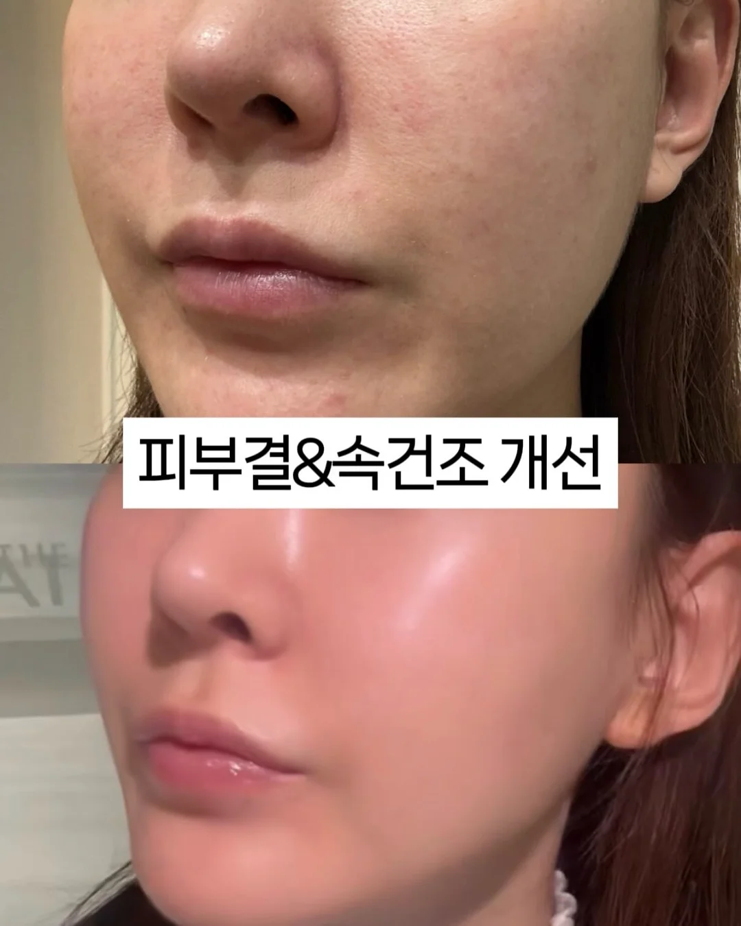 베실 남성 바람막이 3