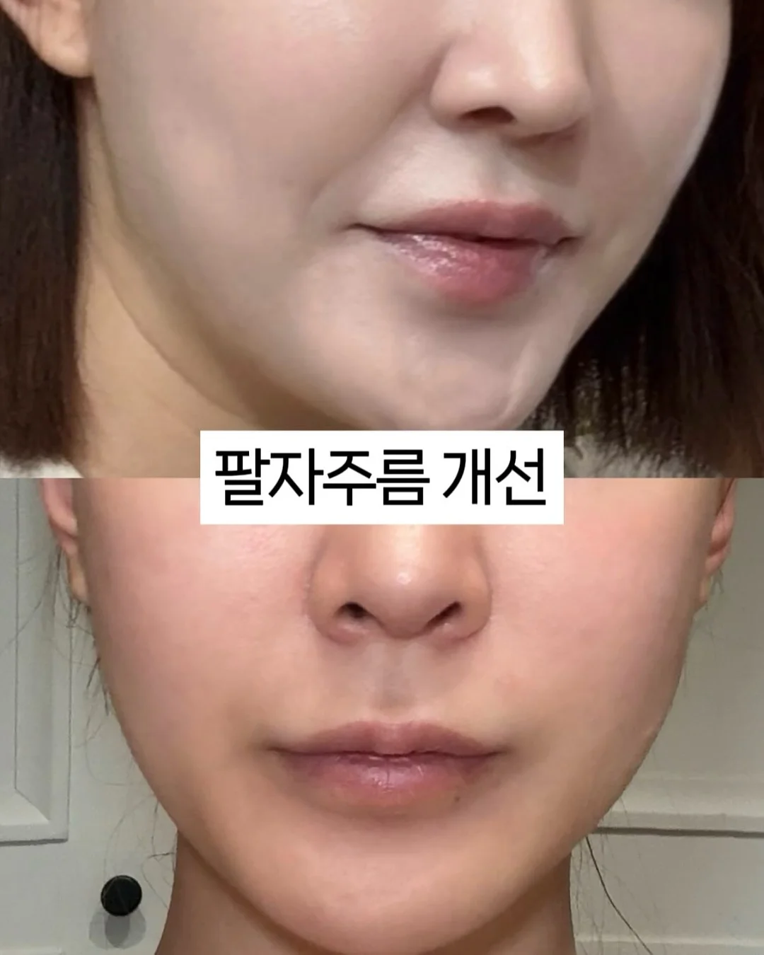 베실 남성 바람막이 4