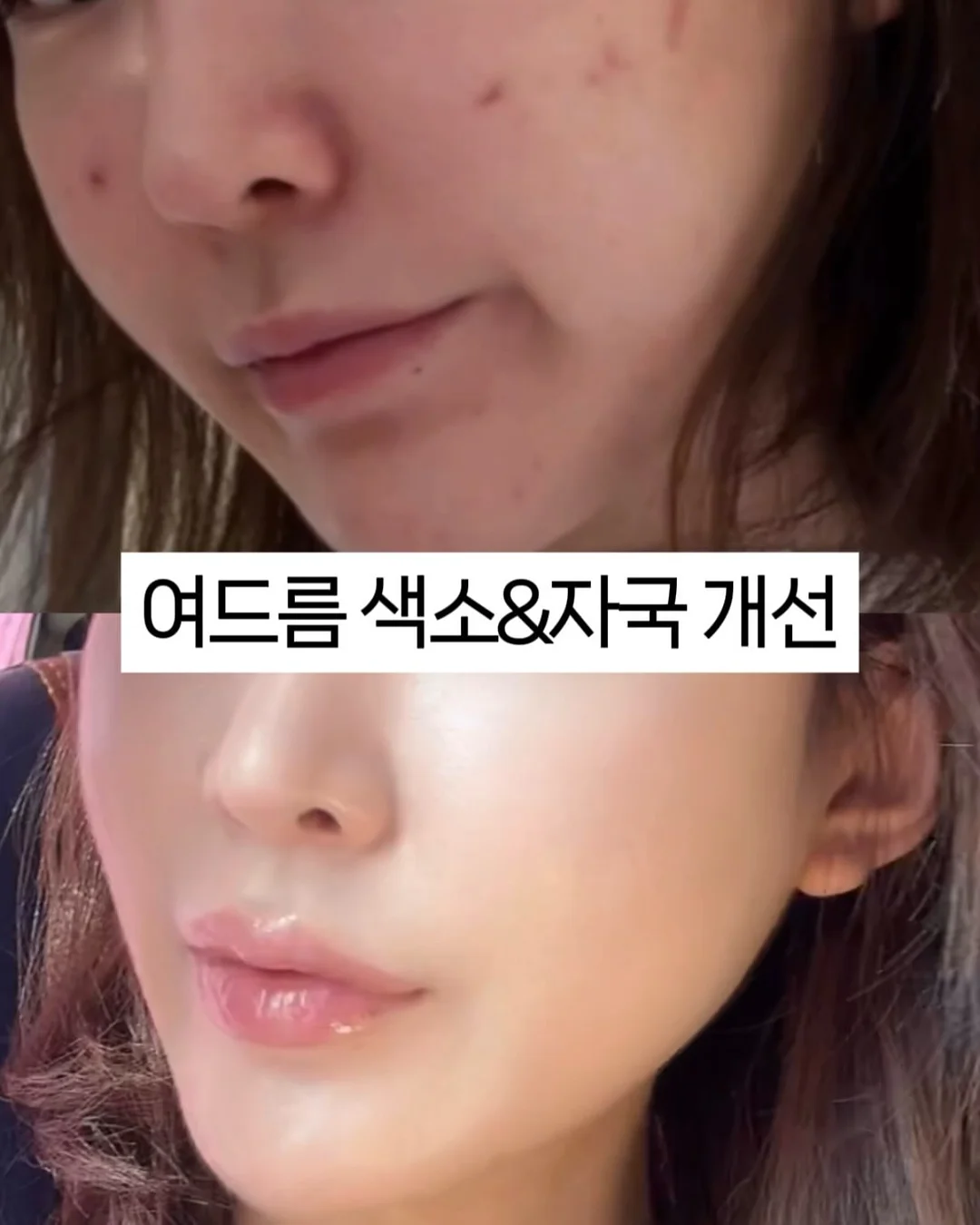 베실 남성 바람막이 5
