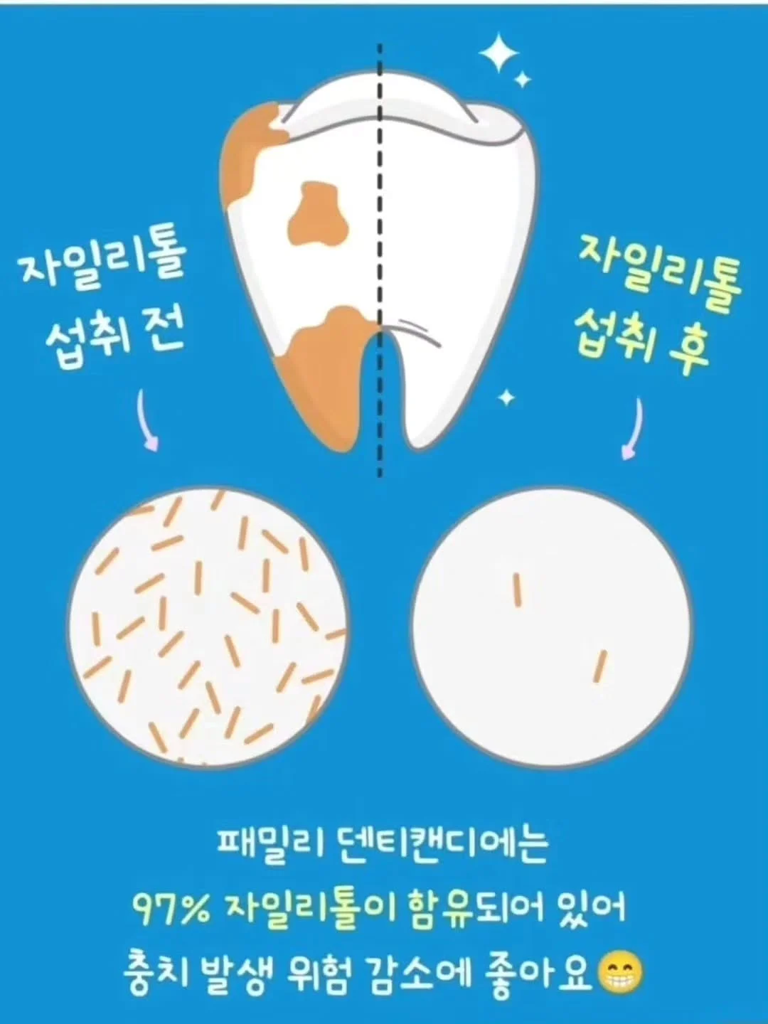 에페이오스 오케아 음파 전동칫솔 7