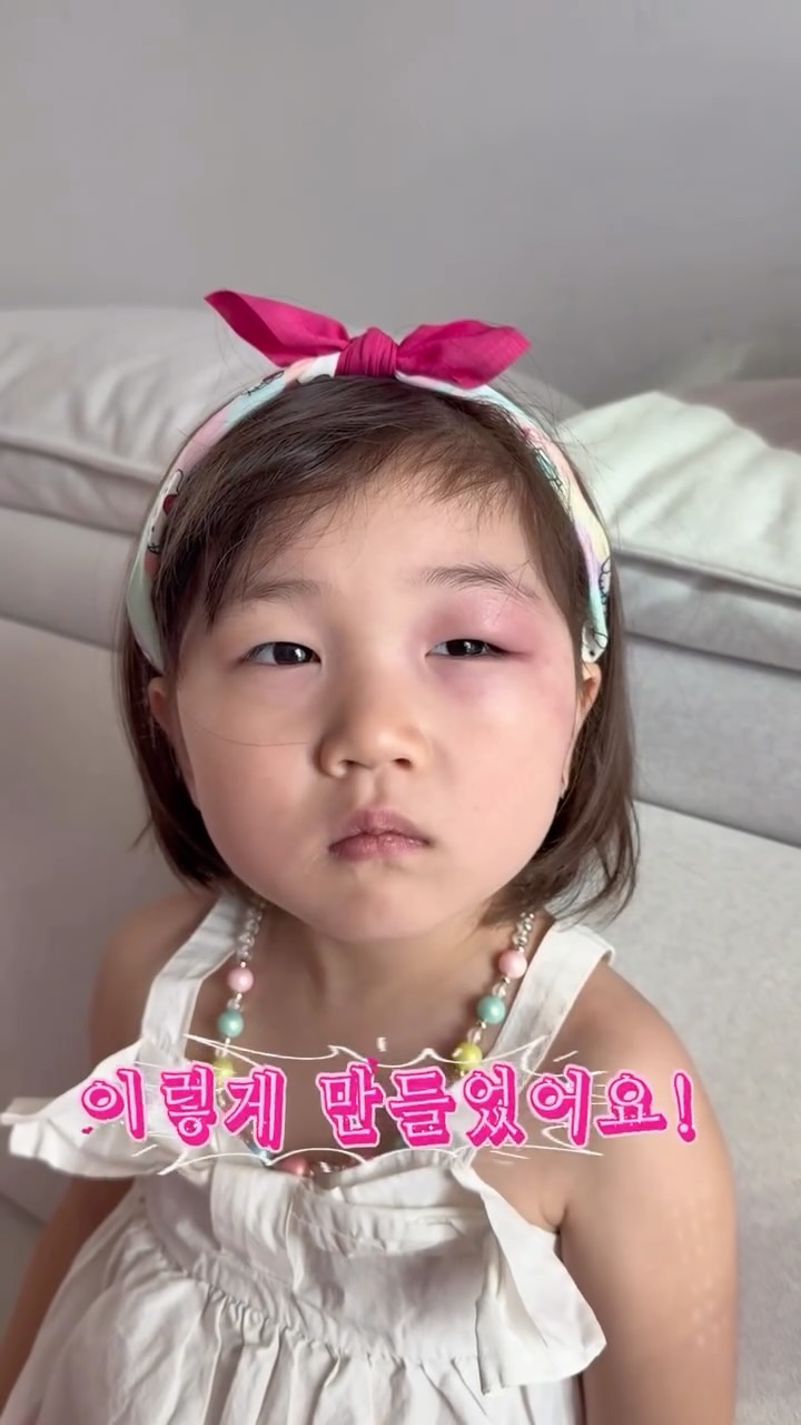 꽃볼 찬기