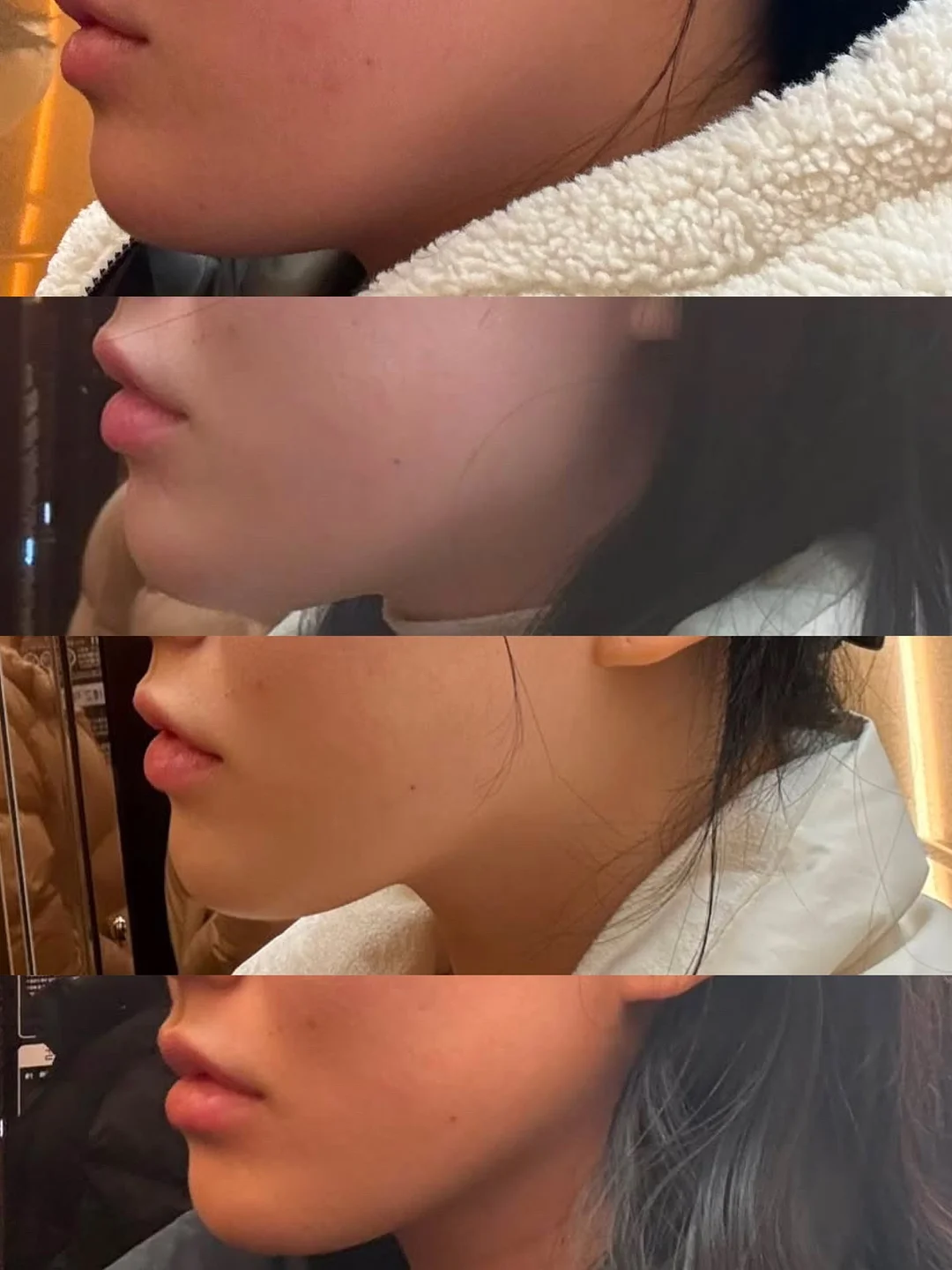 비타민D, 비타민K2, 몰리브덴, 비타민B6 영양제 1