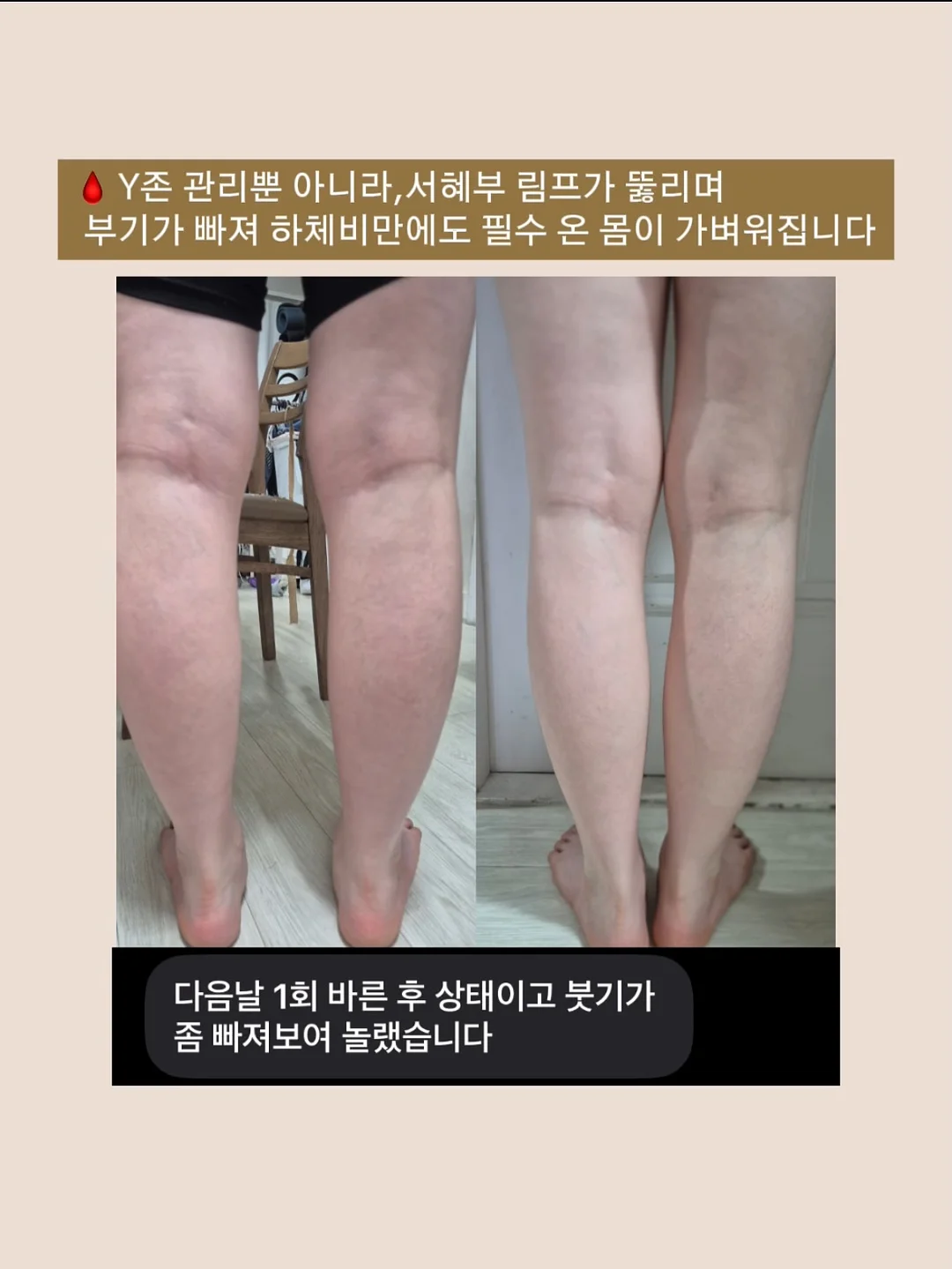 에르 숄 원피스 15