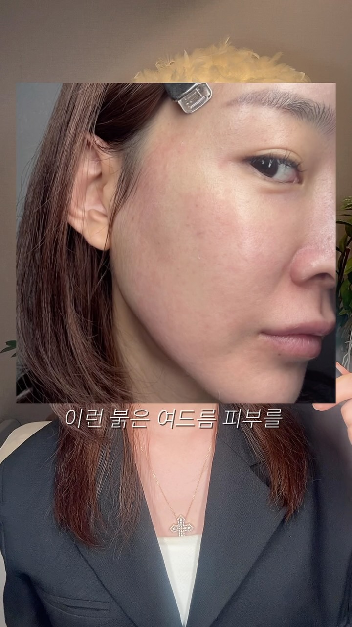 에어매트