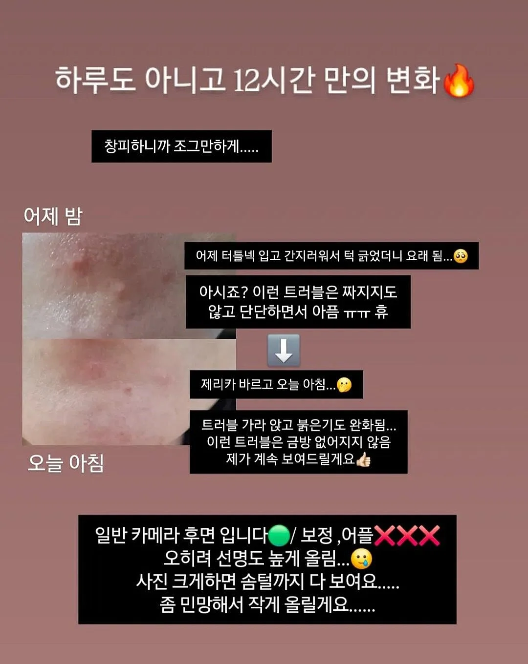 테리우스 가디건 세트 1