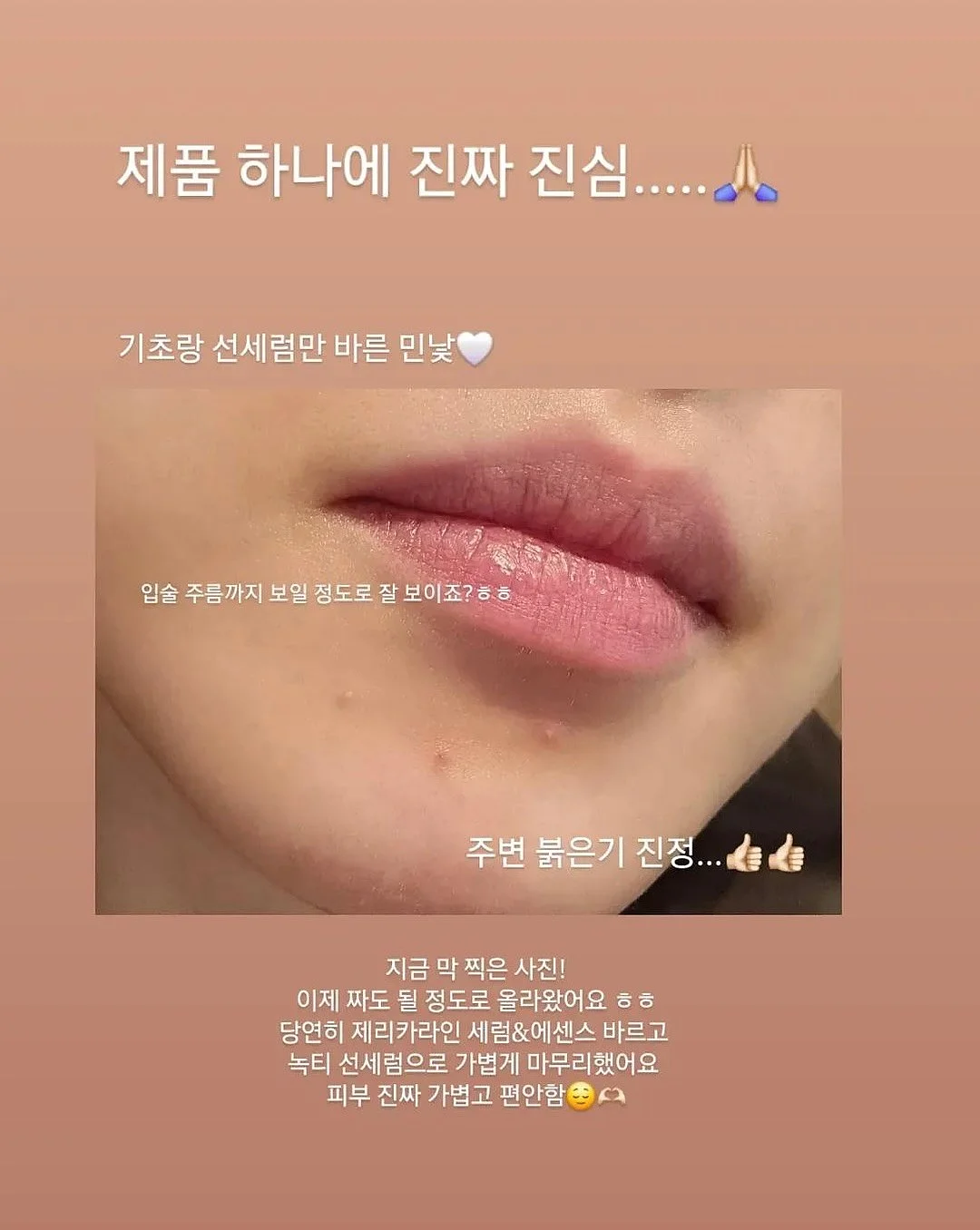 테리우스 가디건 세트 2