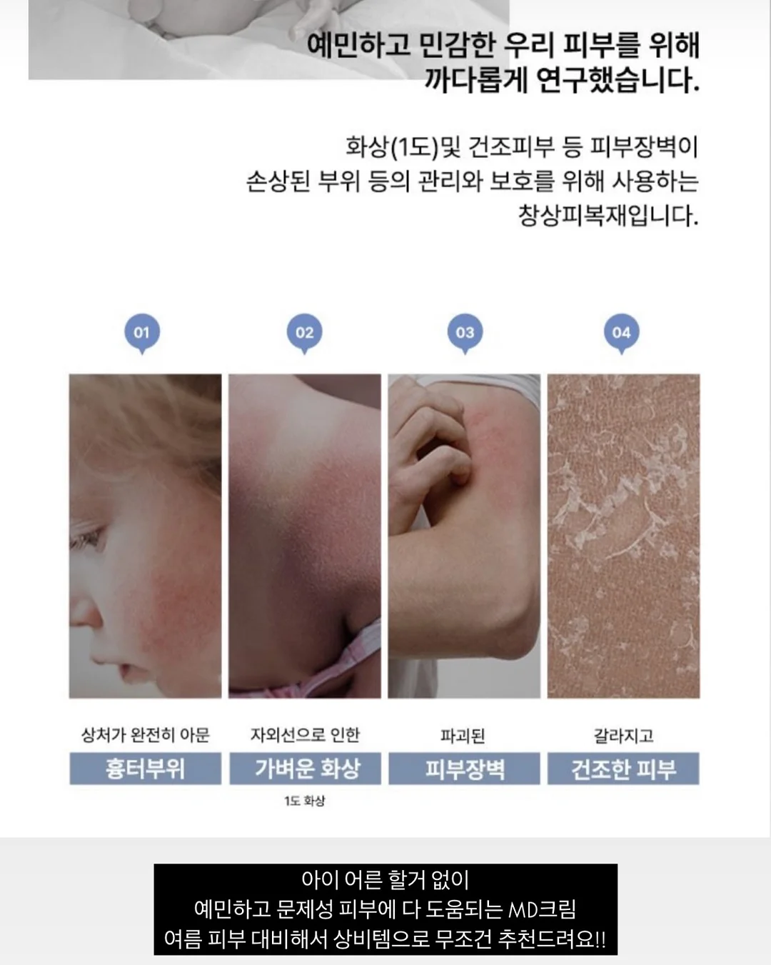 슬리퍼 11
