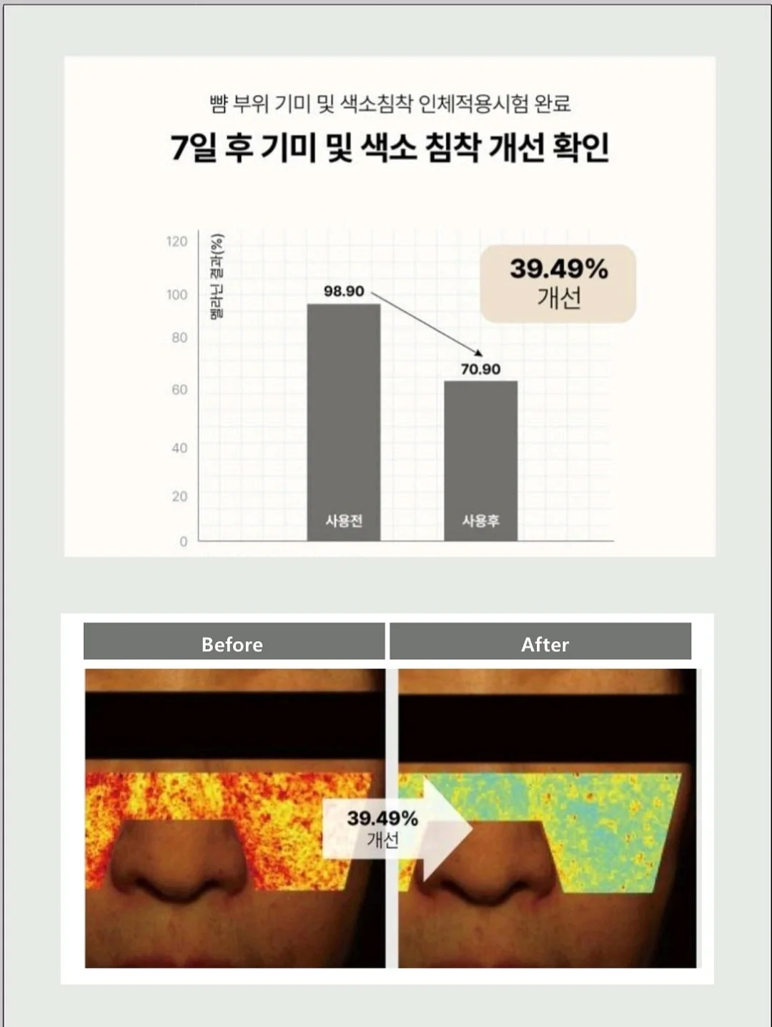 넛세린 시카선스틱 4