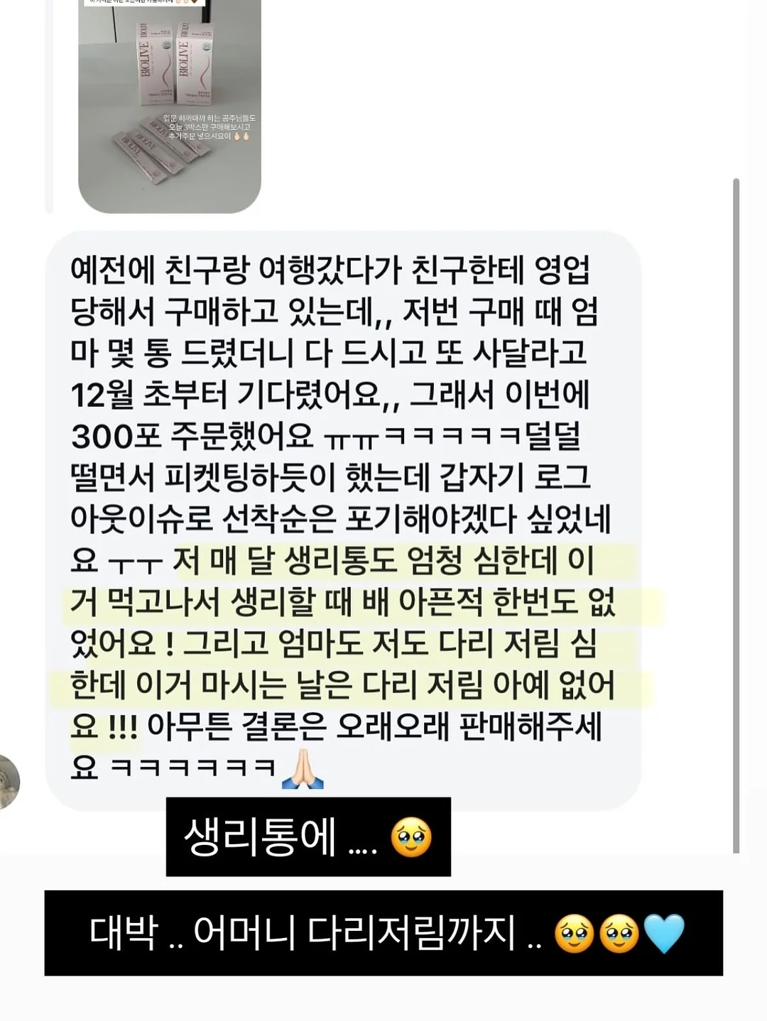 smp 헤어라인 시술 14