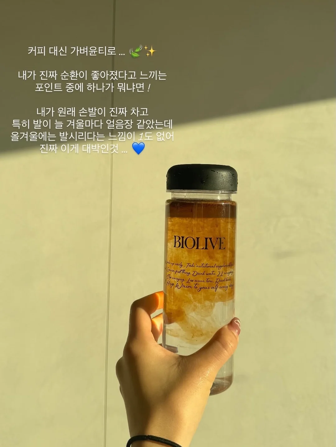 smp 헤어라인 시술 15