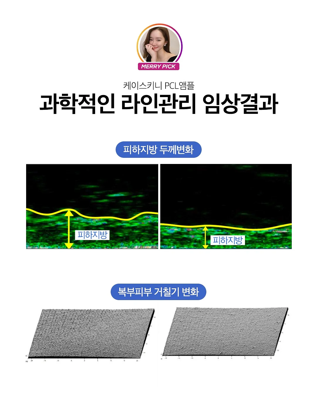 오디션 합격 특급 노하우 13
