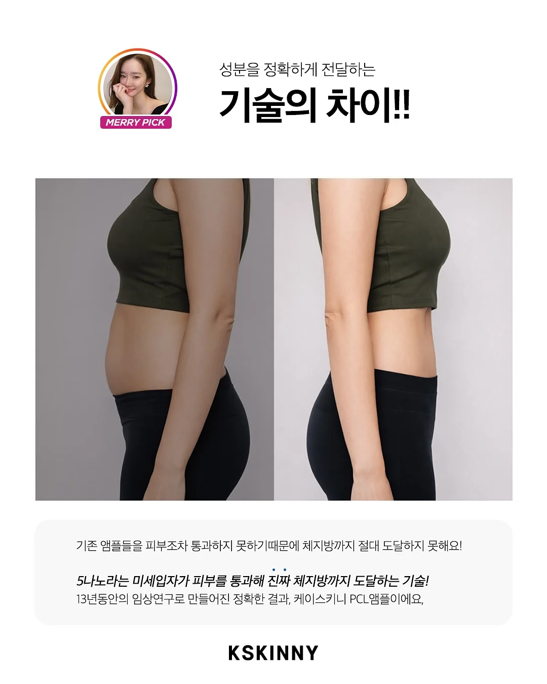 오디션 합격 특급 노하우 10