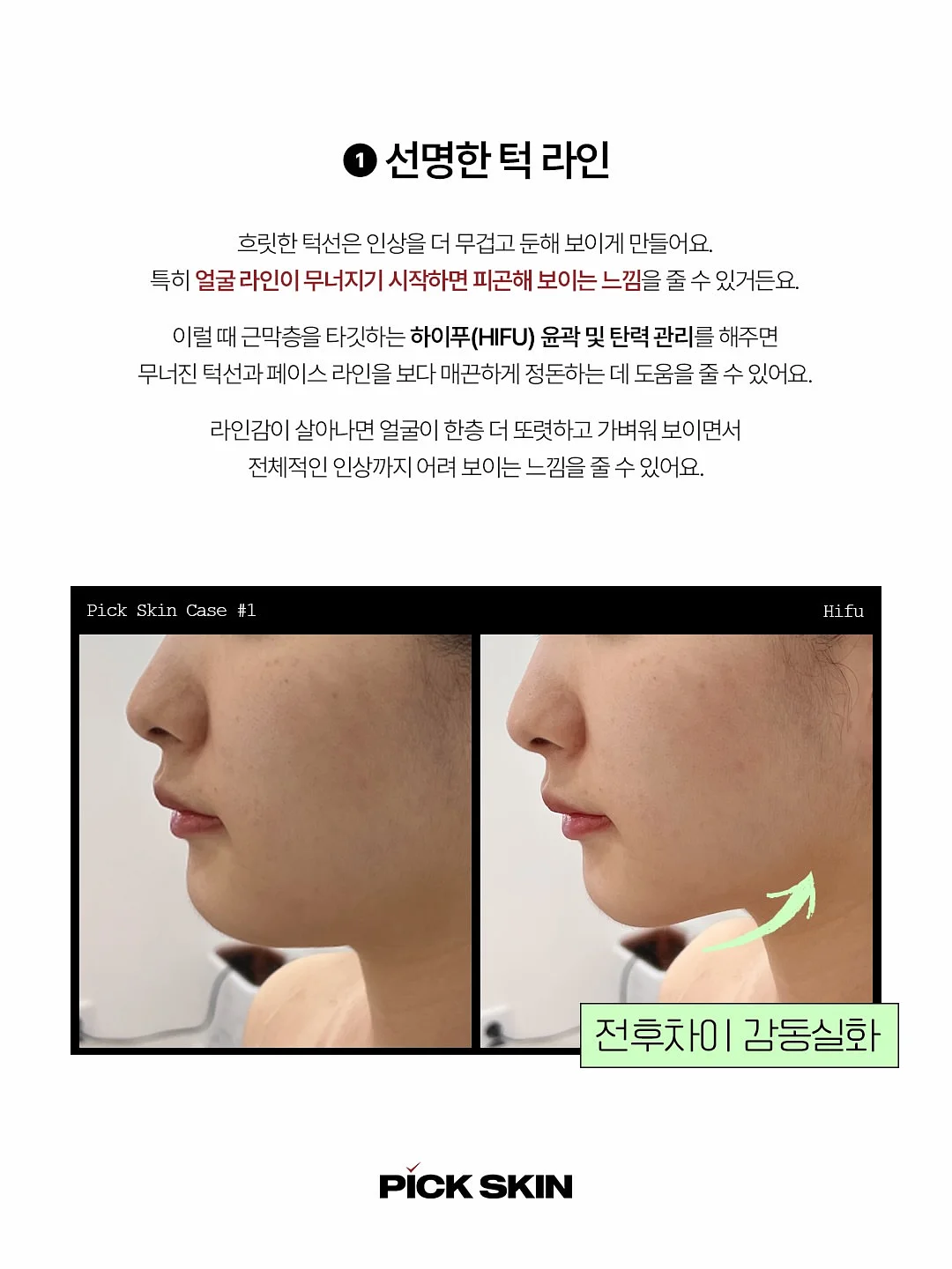 은팔찌 2