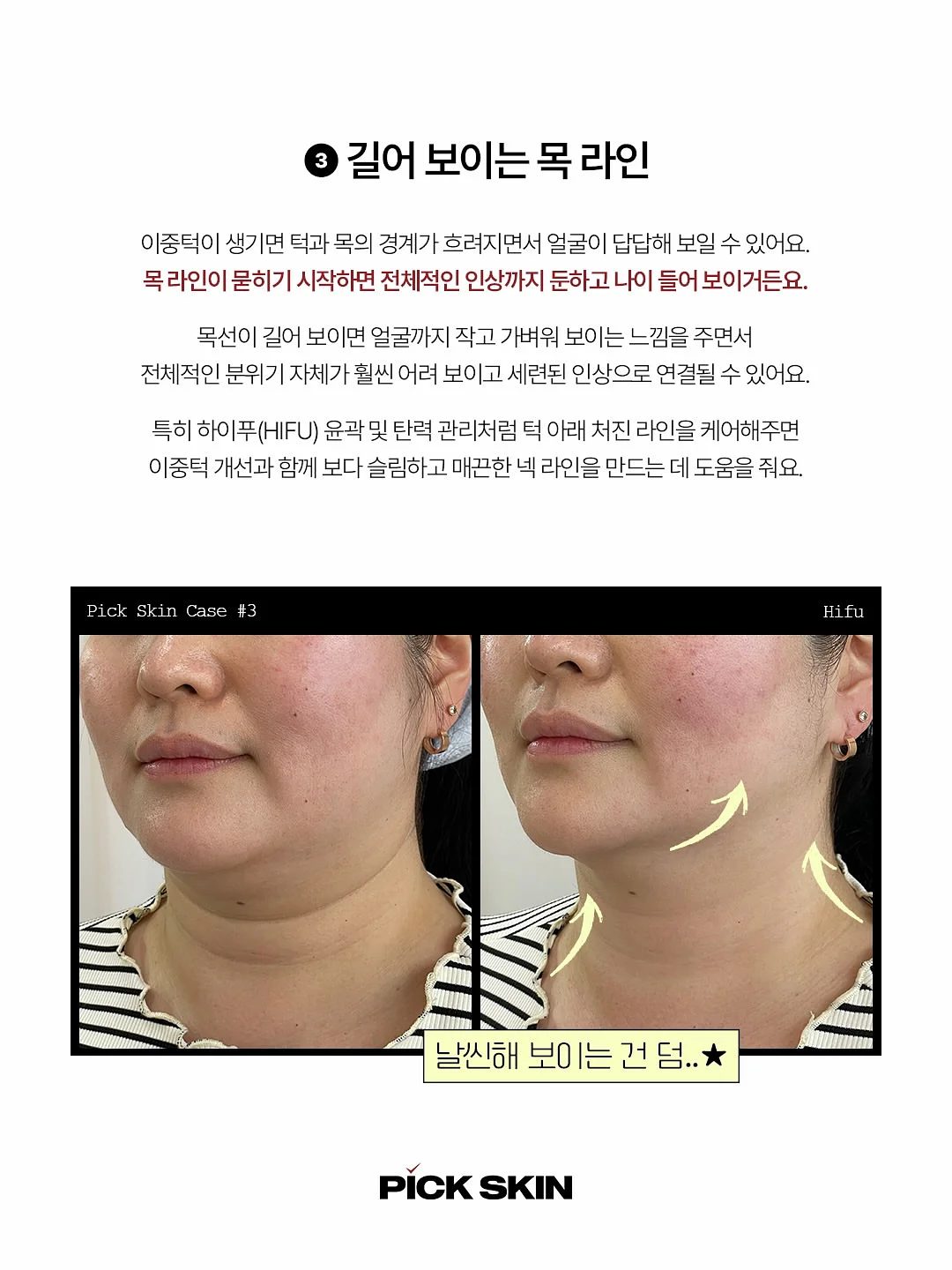 은팔찌 4