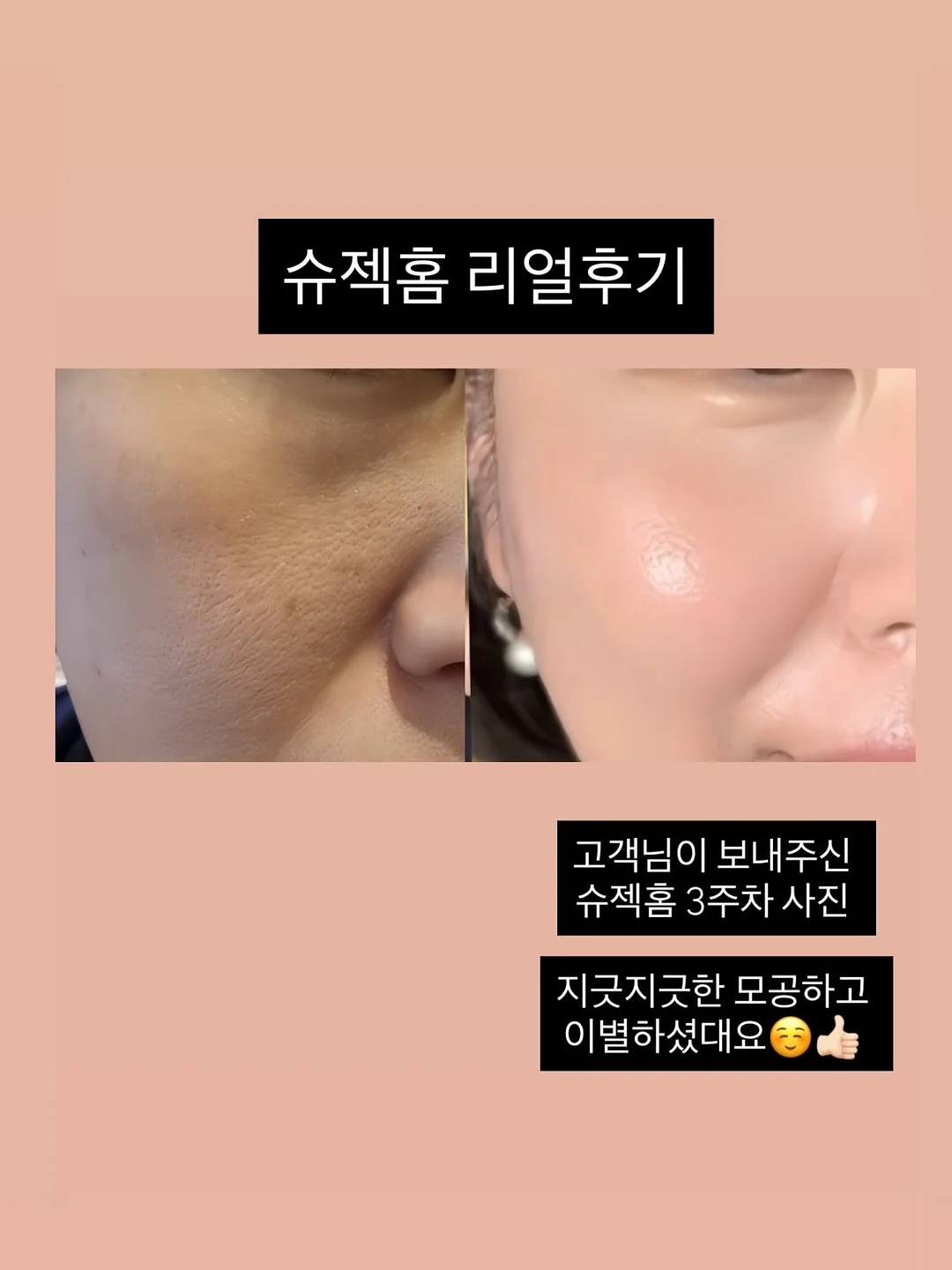 토리야 이자카야 한상 메뉴 6