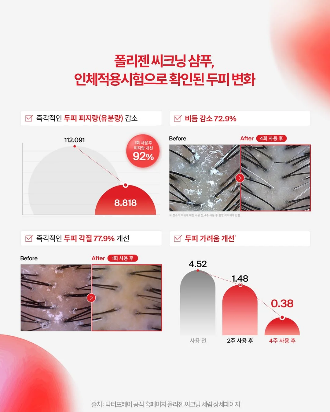 액자 5