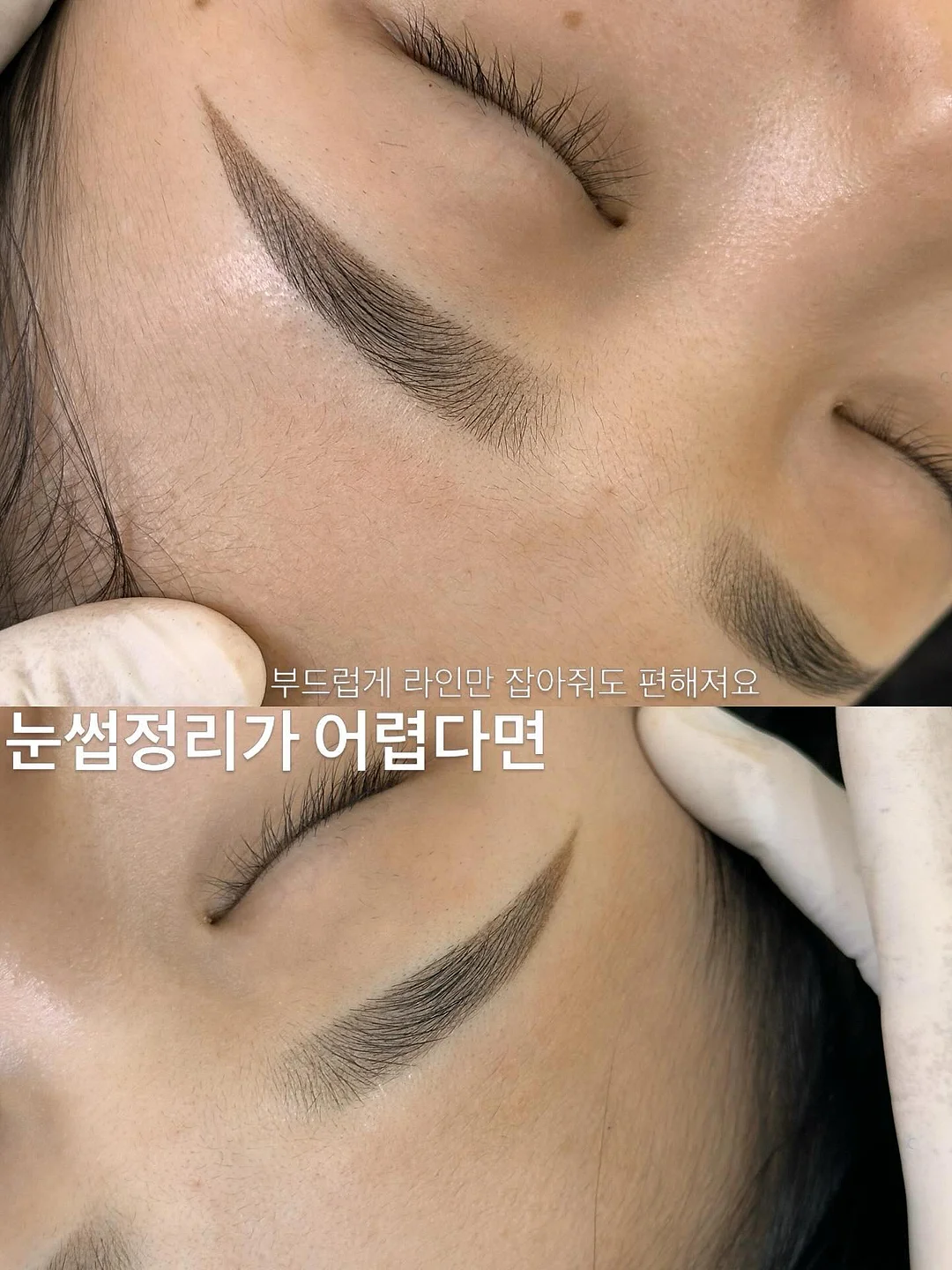 얼라이브랩 두피 관리 세트 5