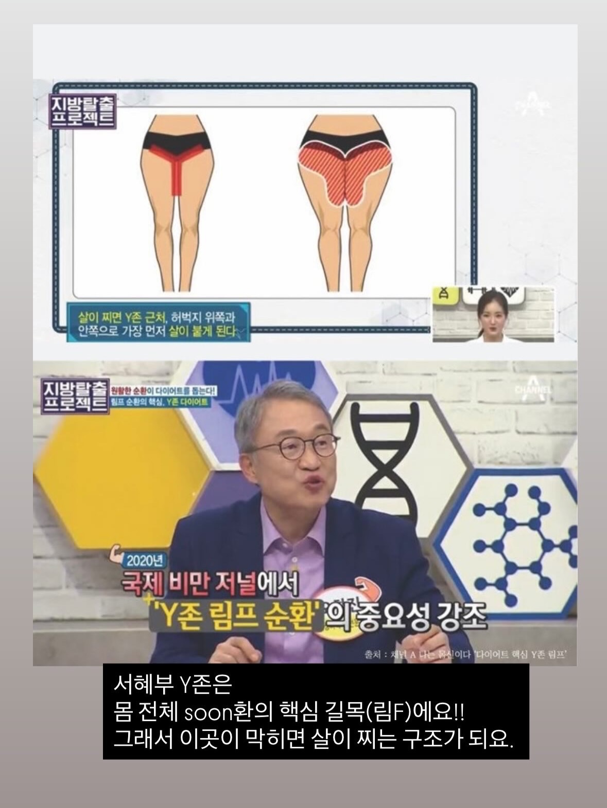 링클세트 2