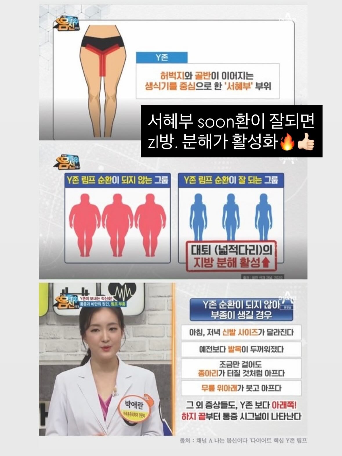 링클세트 3
