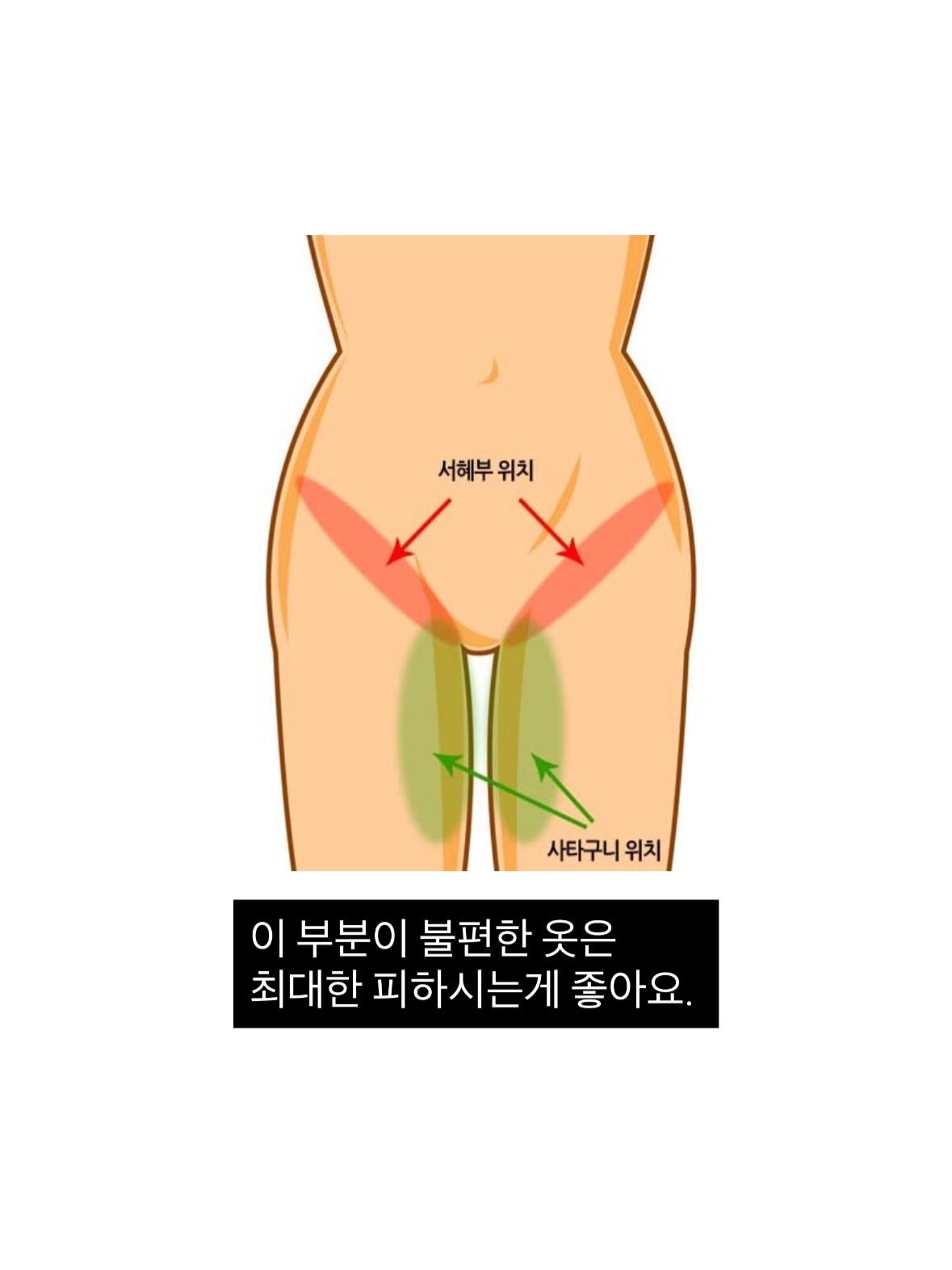 링클세트 4