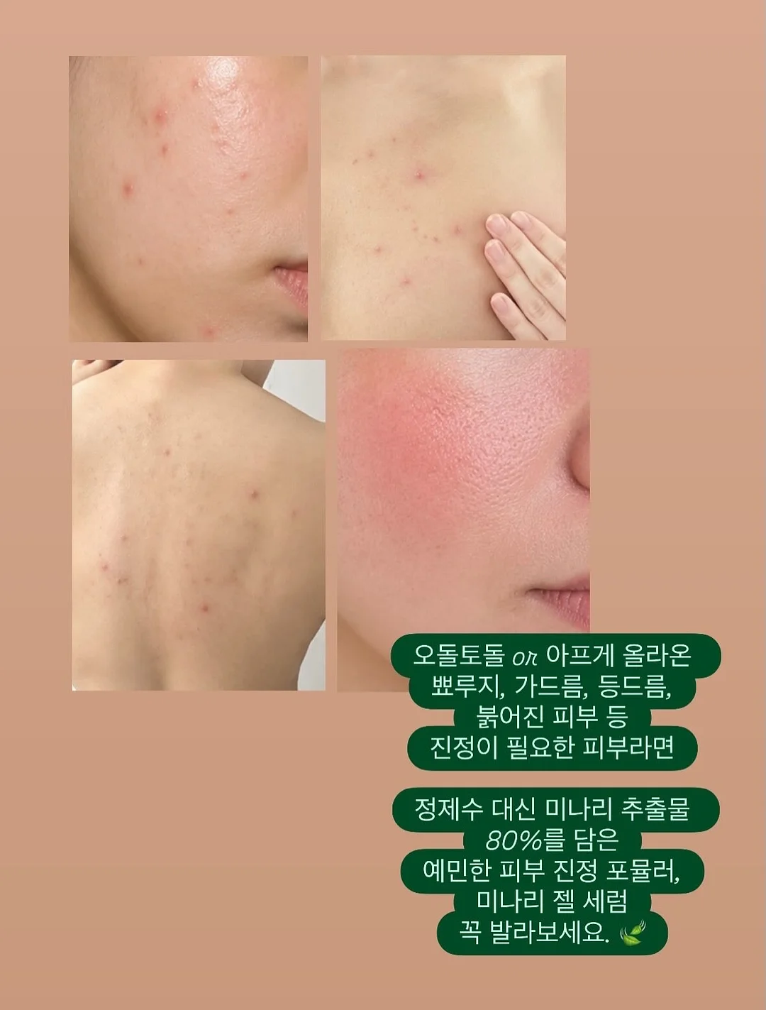 함익병 풋크림 14