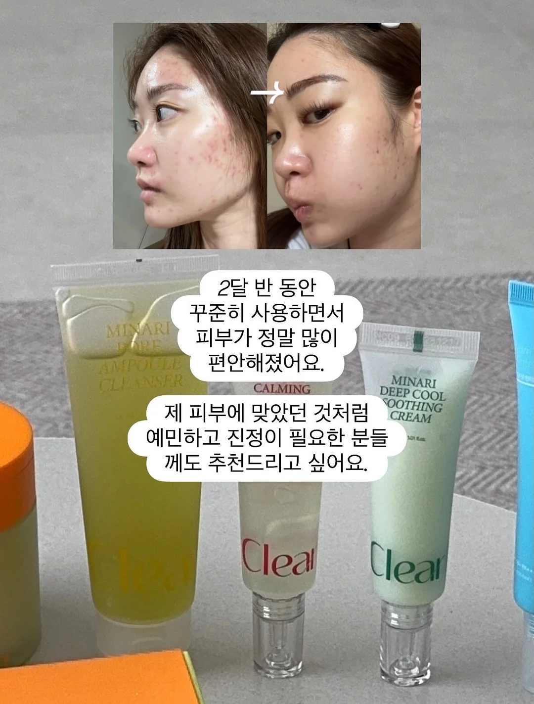 함익병 풋크림 18