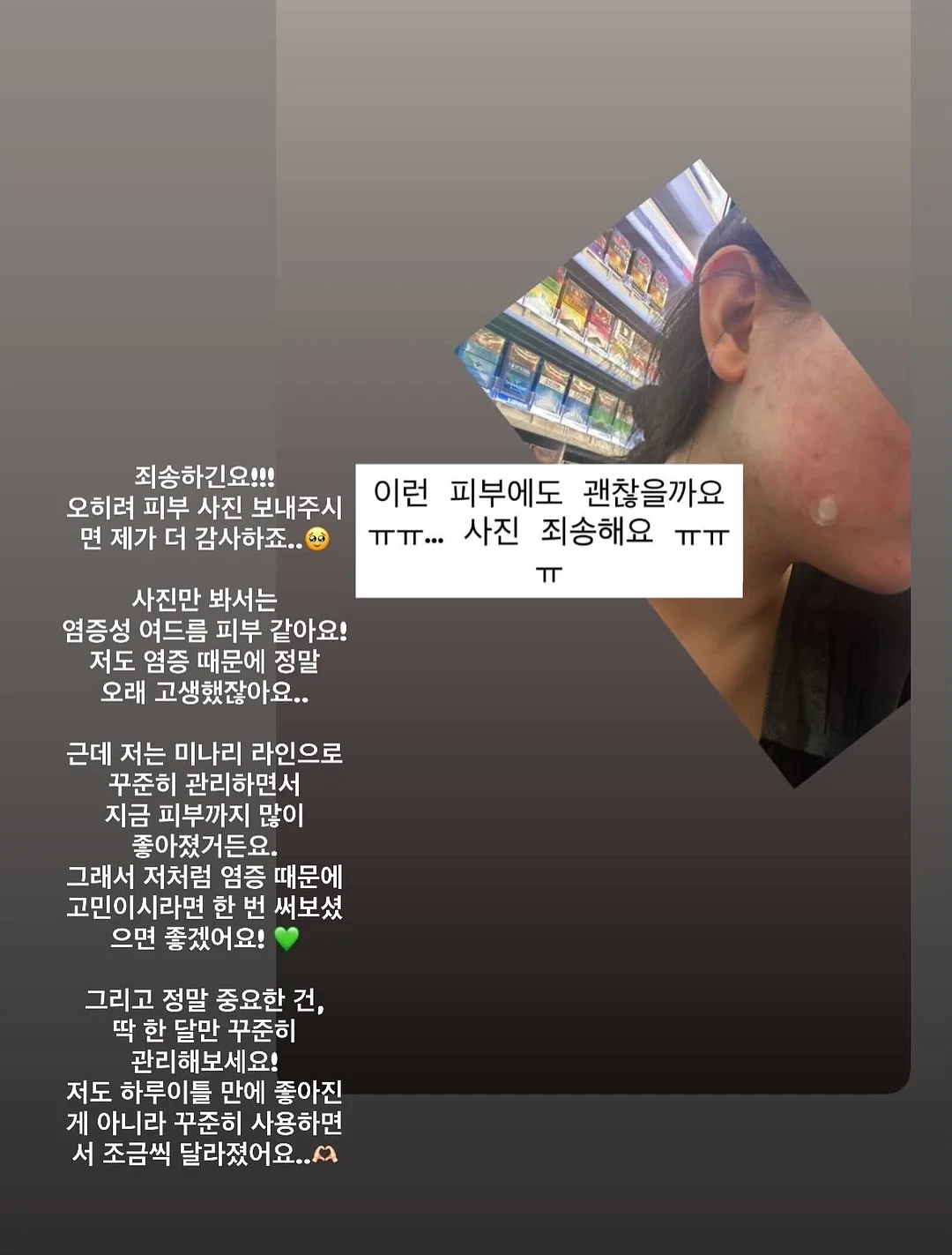 함익병 풋크림 19