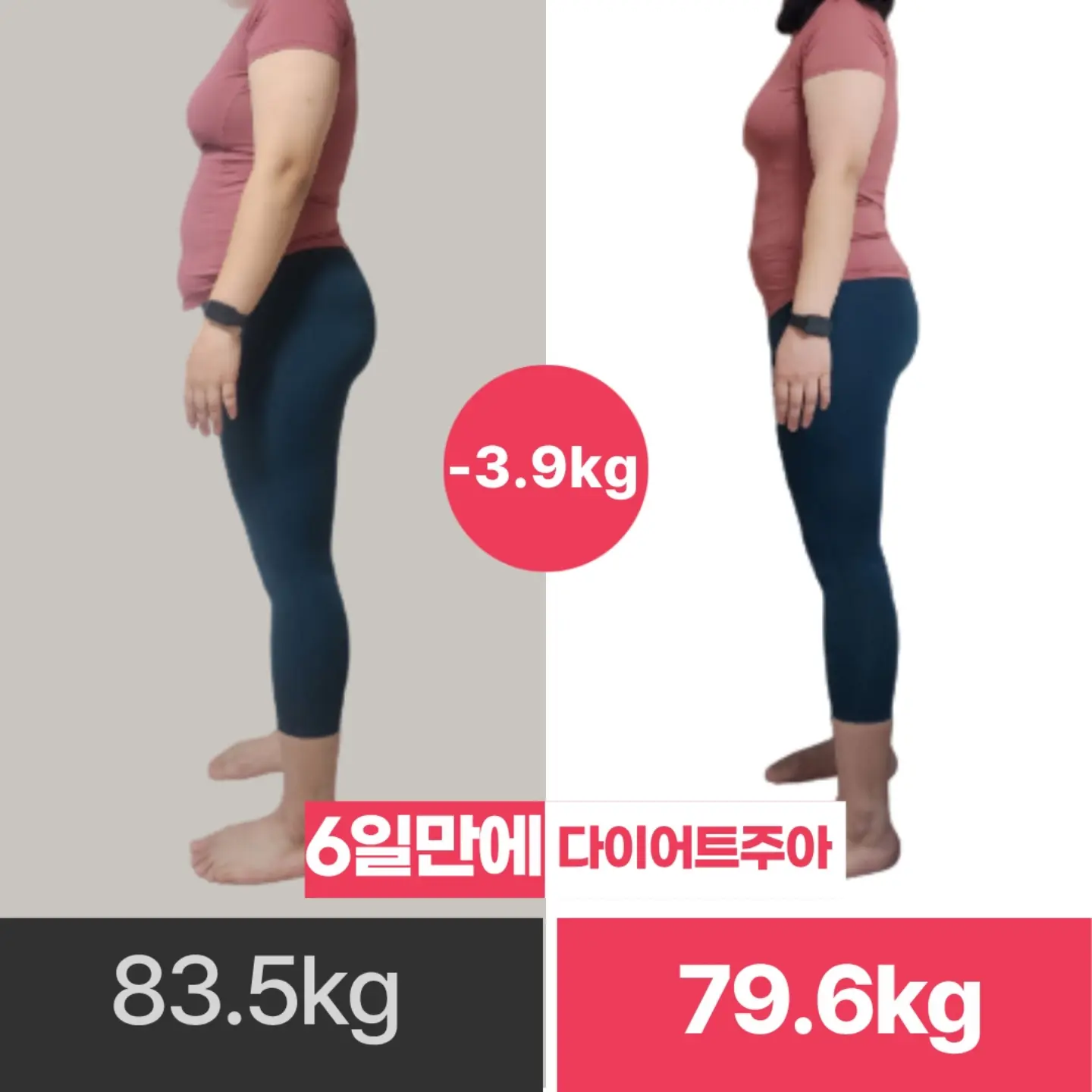 치과위생사 국가고시 스티커 1