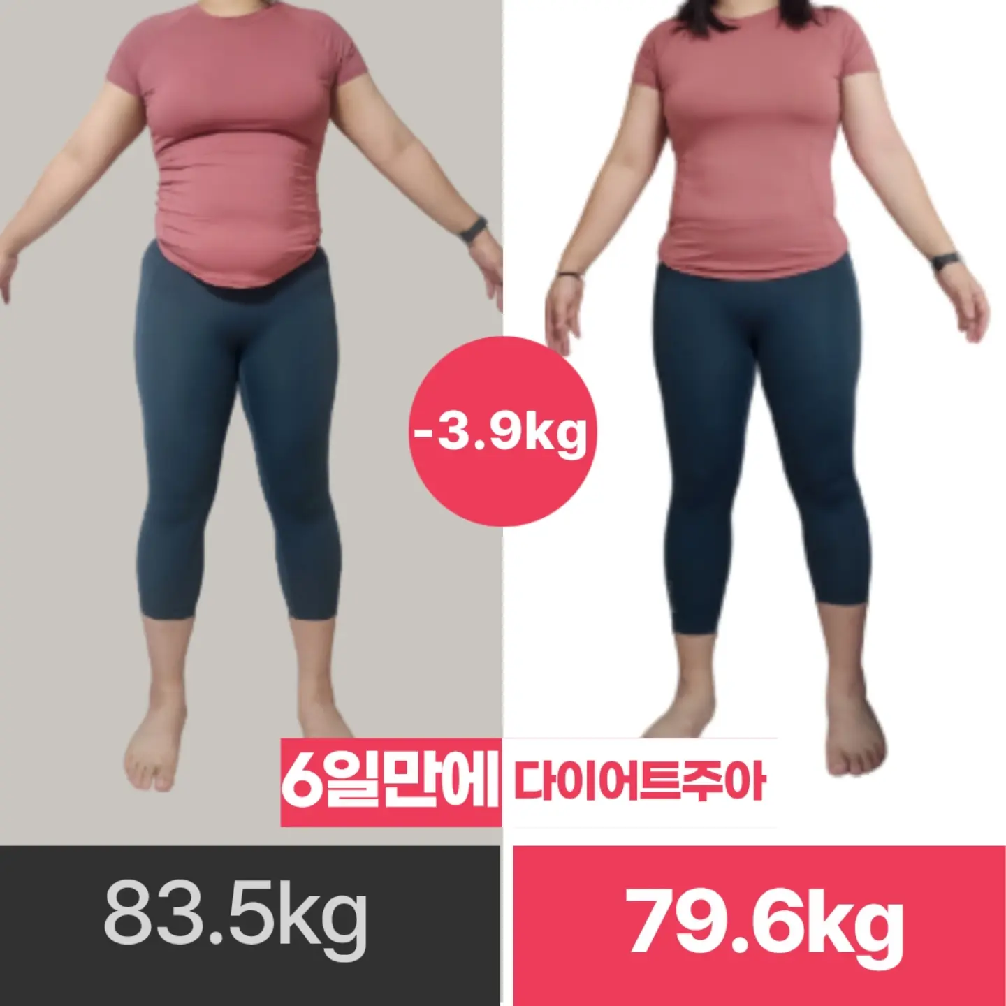 치과위생사 국가고시 스티커 2