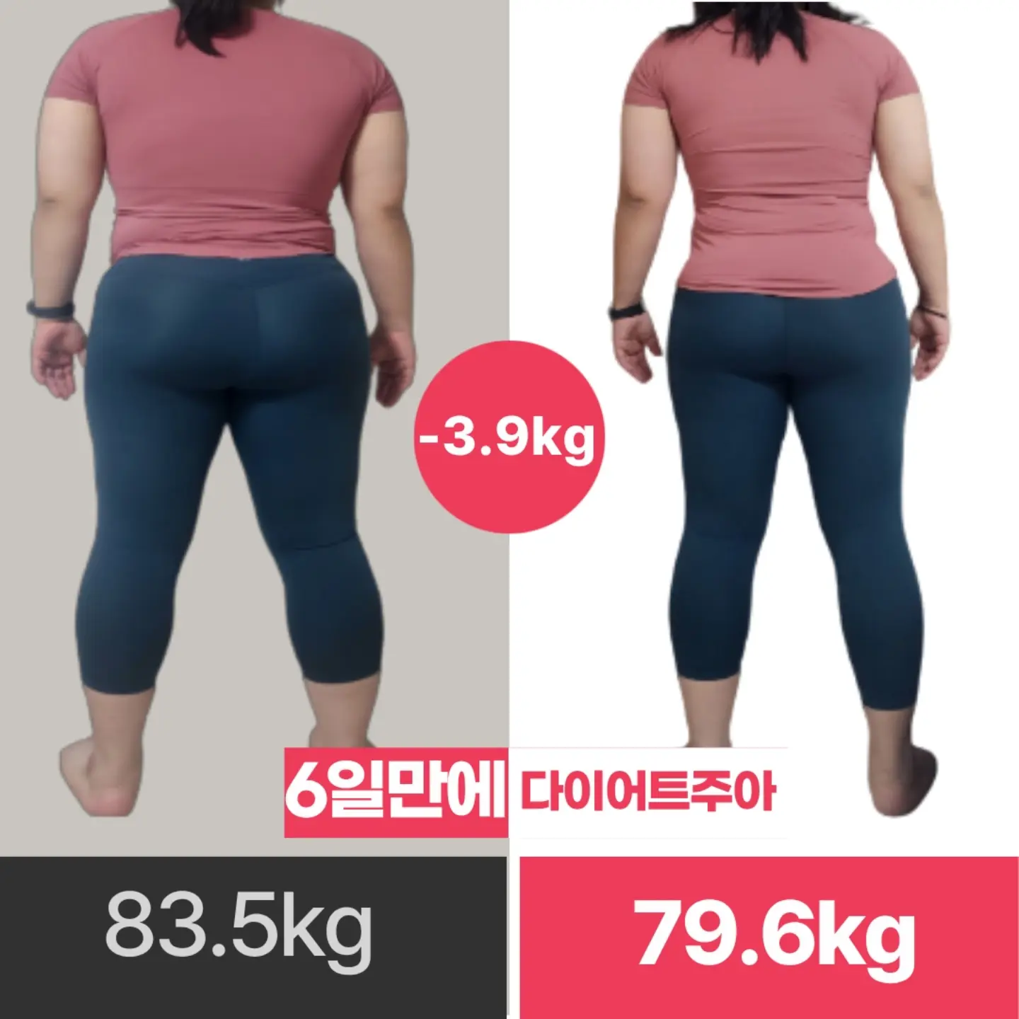 치과위생사 국가고시 스티커 3