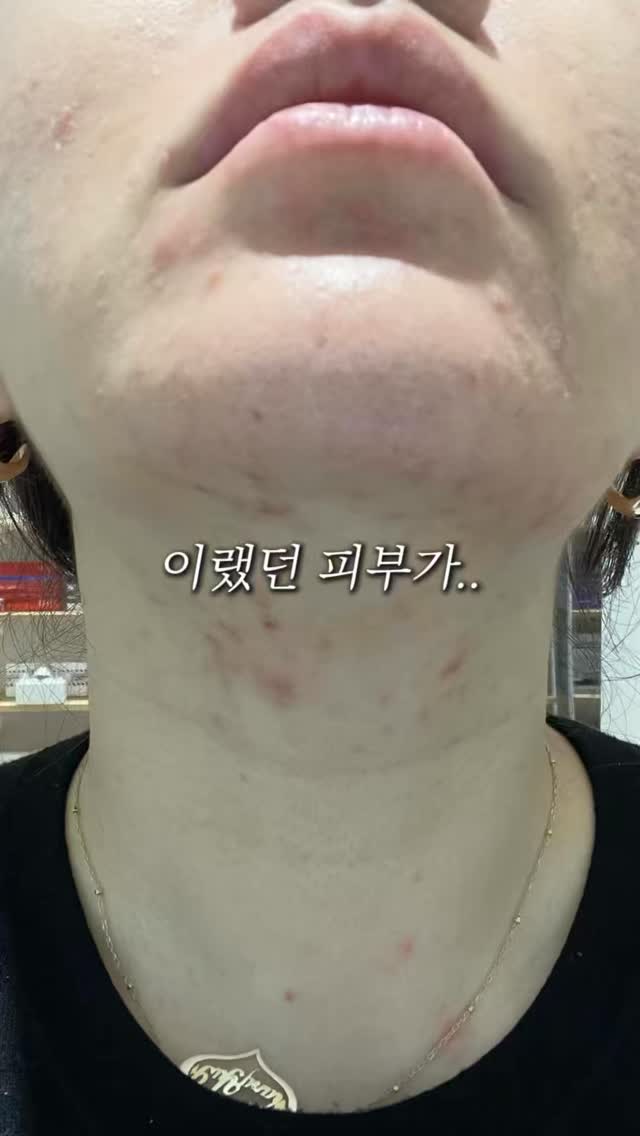 초등 백팩
