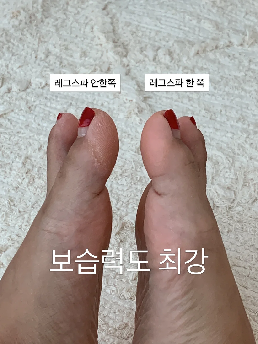 얼라이브랩 멀티 아이스 B5 크림 16
