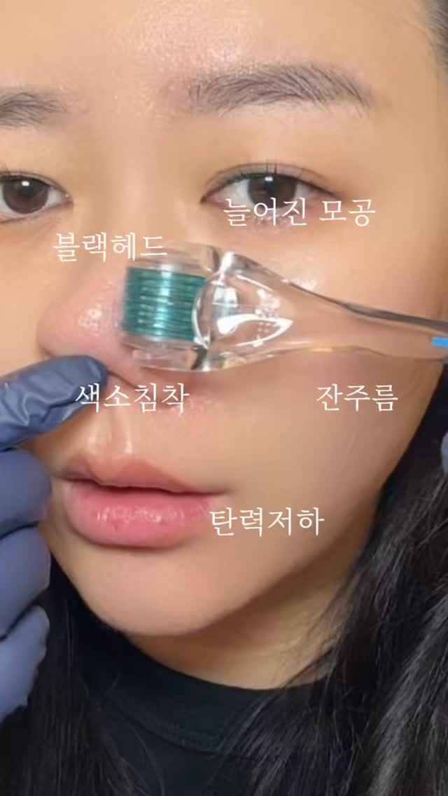 디즈니 아디다스 콜라보 운동화