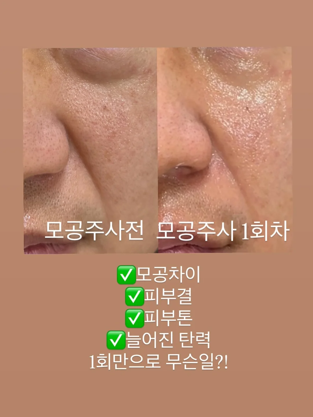 천연 위고비 레시피 11