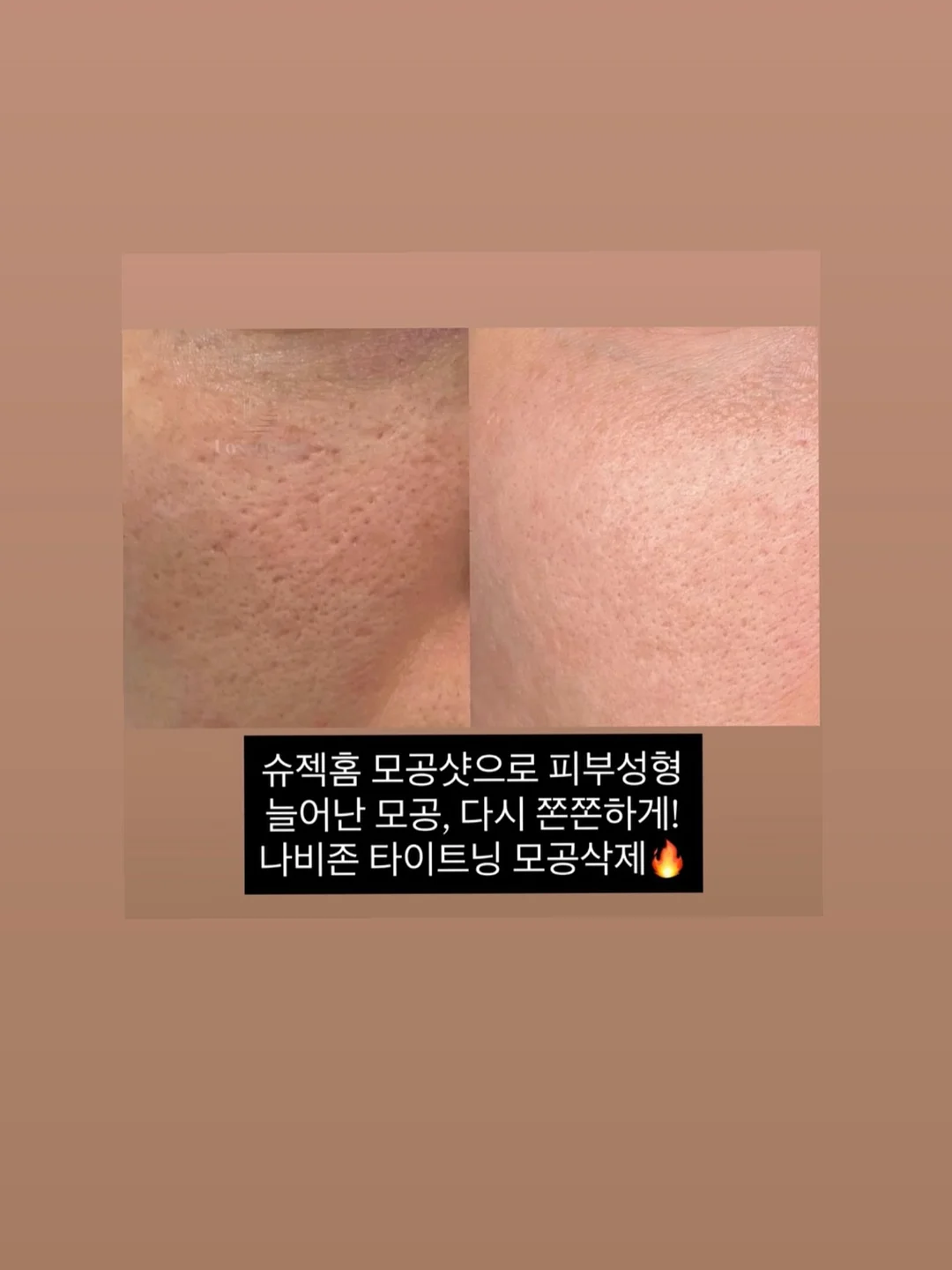 천연 위고비 레시피 12