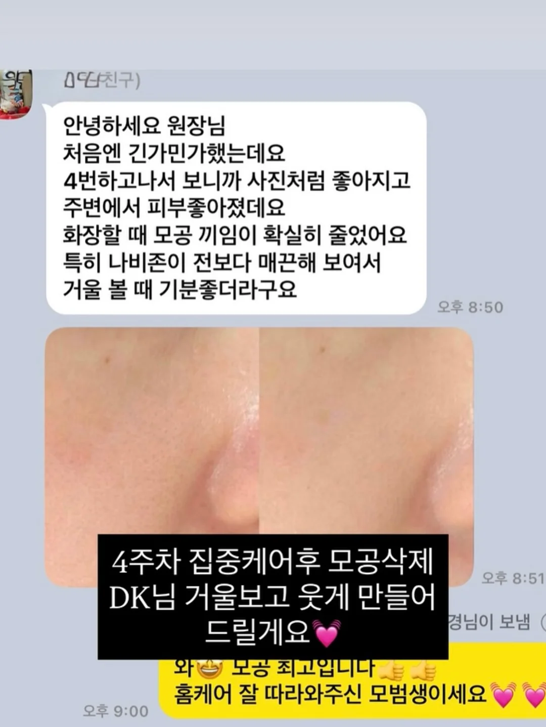 천연 위고비 레시피 14