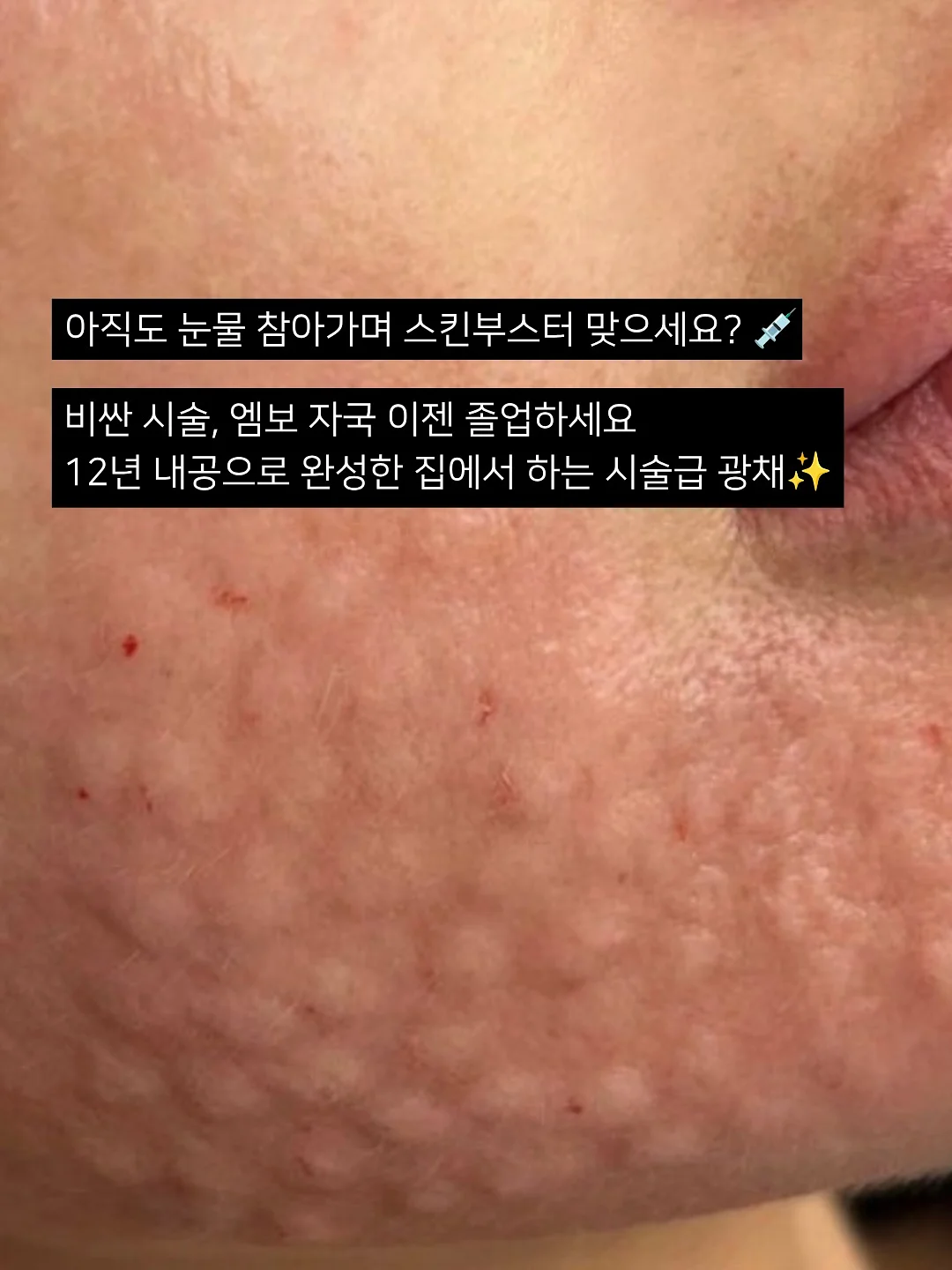 천연 위고비 레시피 15
