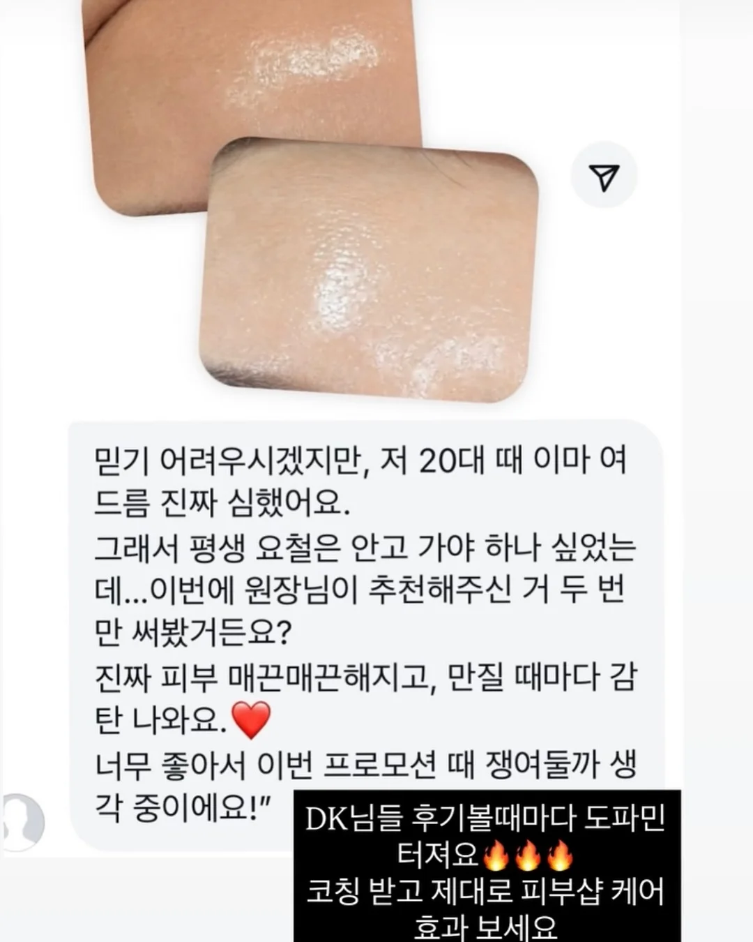 천연 위고비 레시피 10