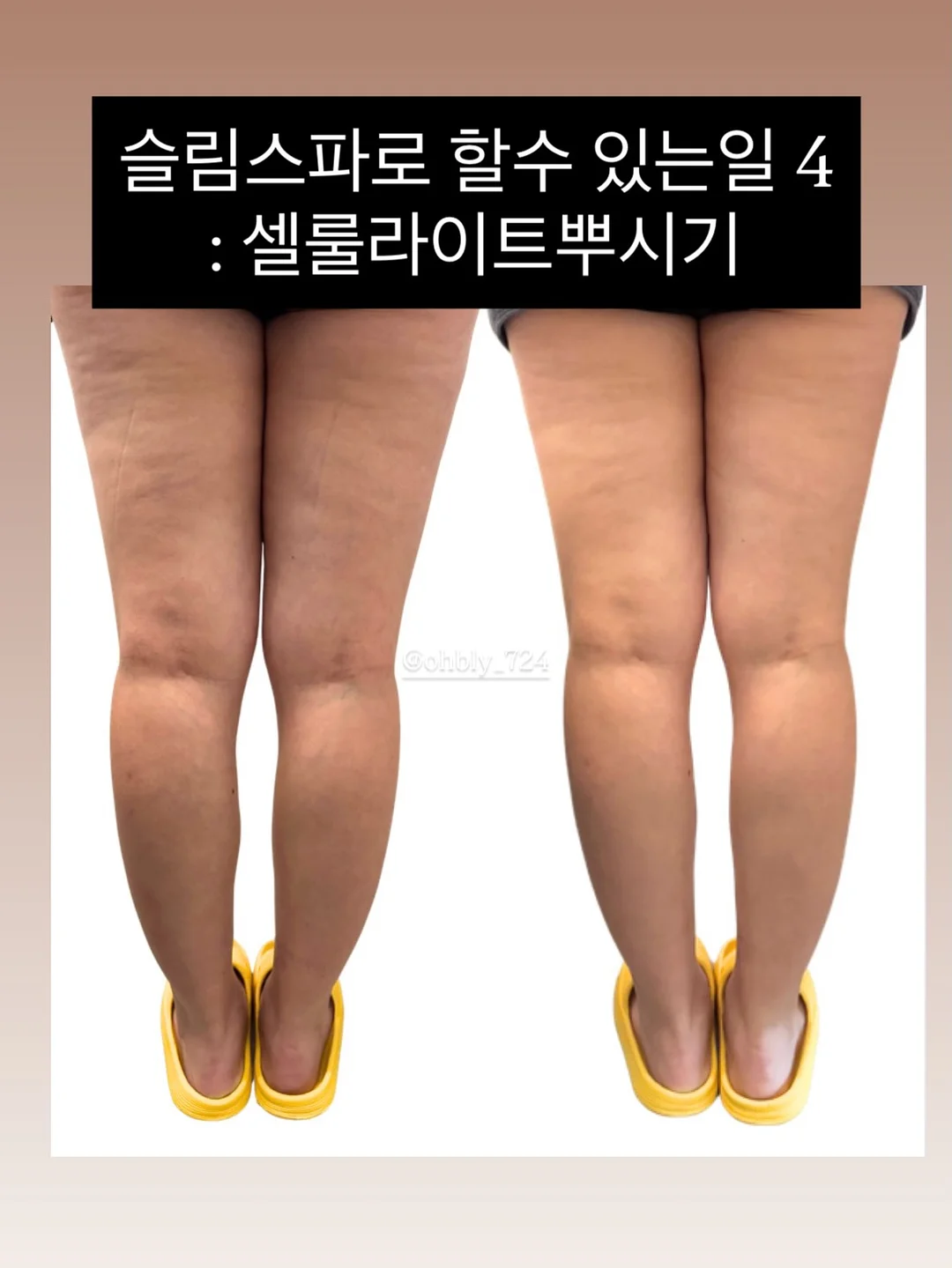 여름 반팔티 5