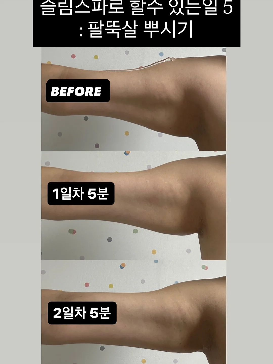 여름 반팔티 6