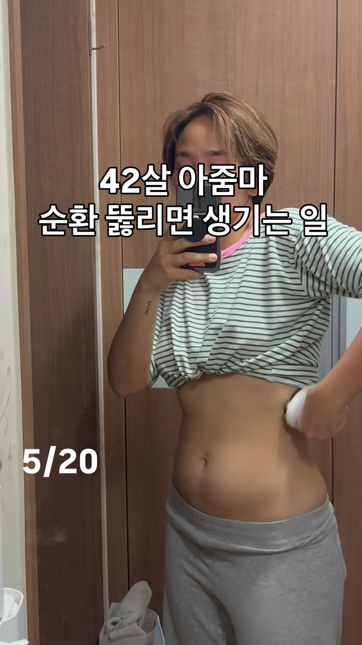 노팅 티