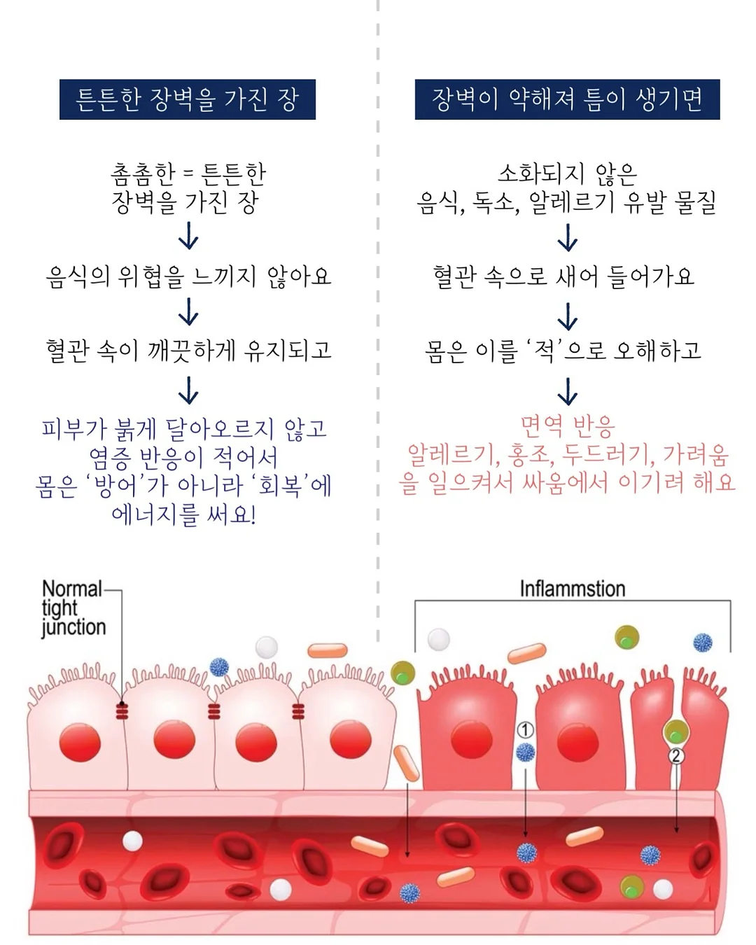 탄력앰플 7